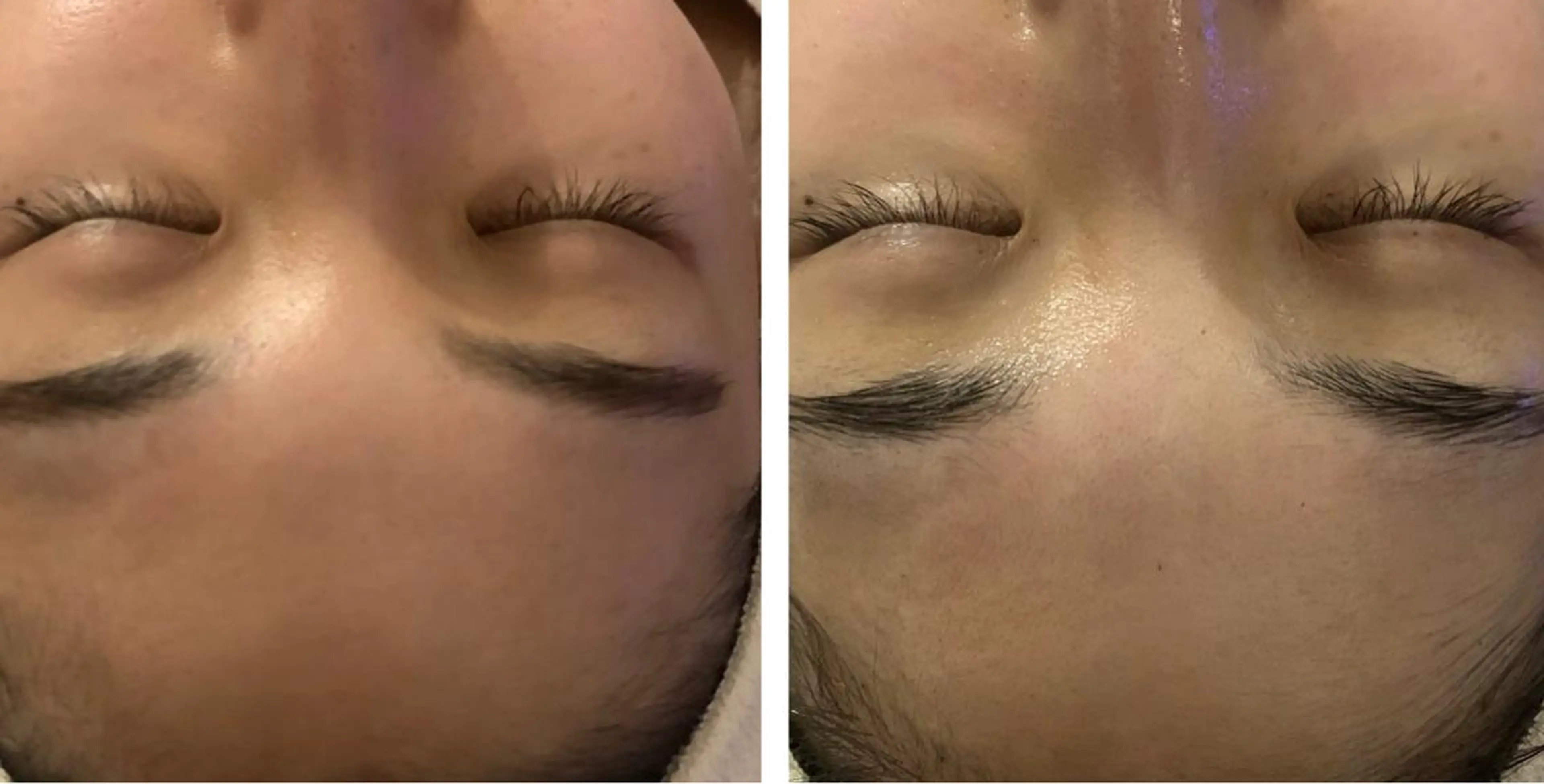 エステfreep takamoriのエステ・リラクイメージ