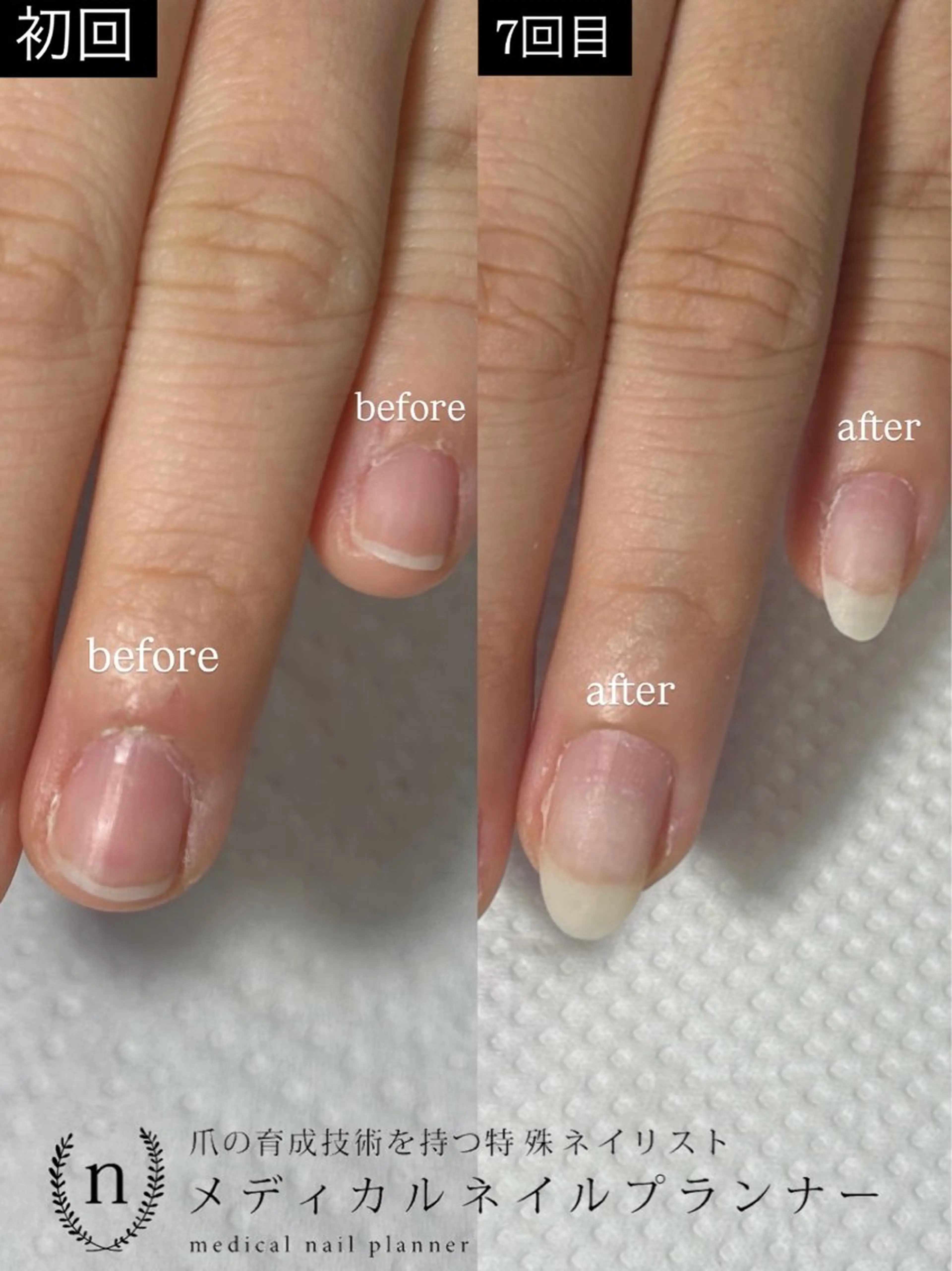 ネイル ハンドネイル Lofinails ちひろのネイルデザイン