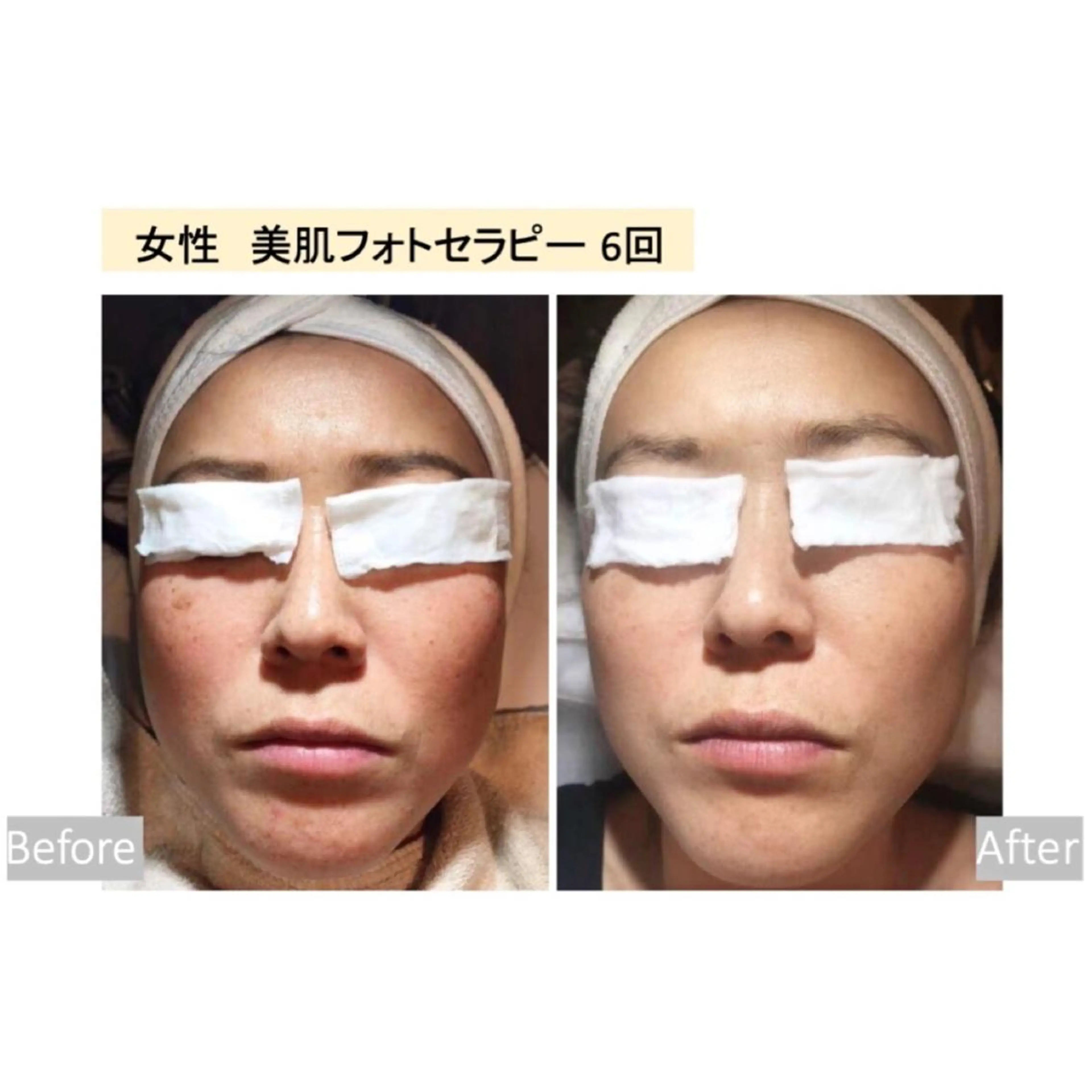 美肌脱毛i所属・美肌脱毛ｉ ｜泉大津のエステ・リラクイメージ