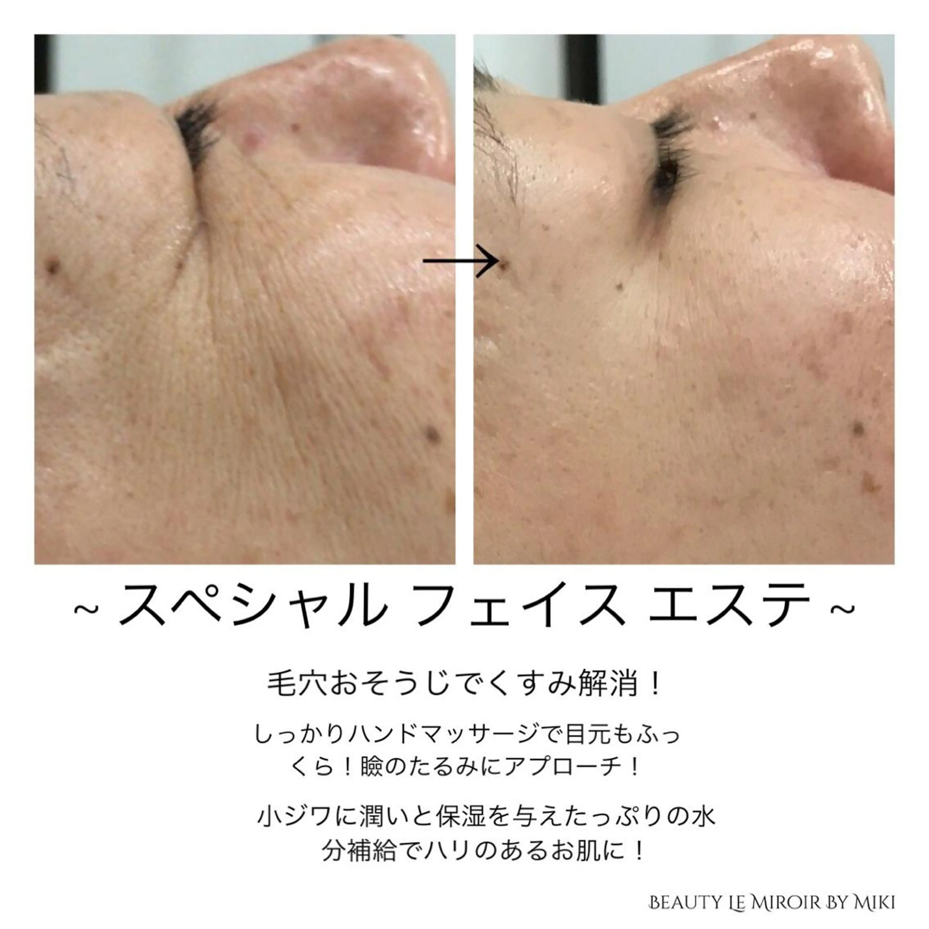 ビューティー ミロワールのエステ・リラクイメージ