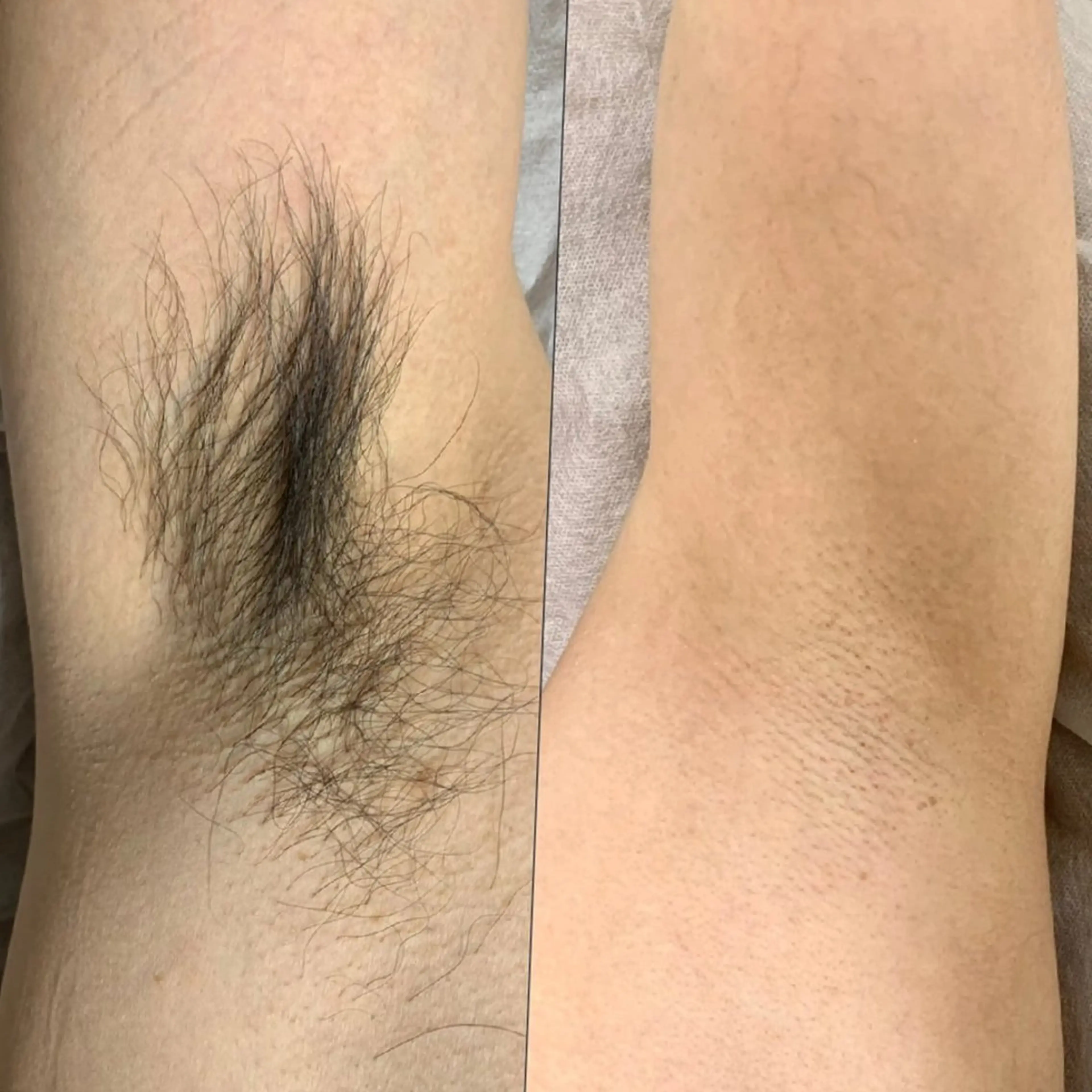 脱毛 脱毛・小顔専門サロンLUANA所属・脱毛&シェービング 専門店 平岡のその他イメージ