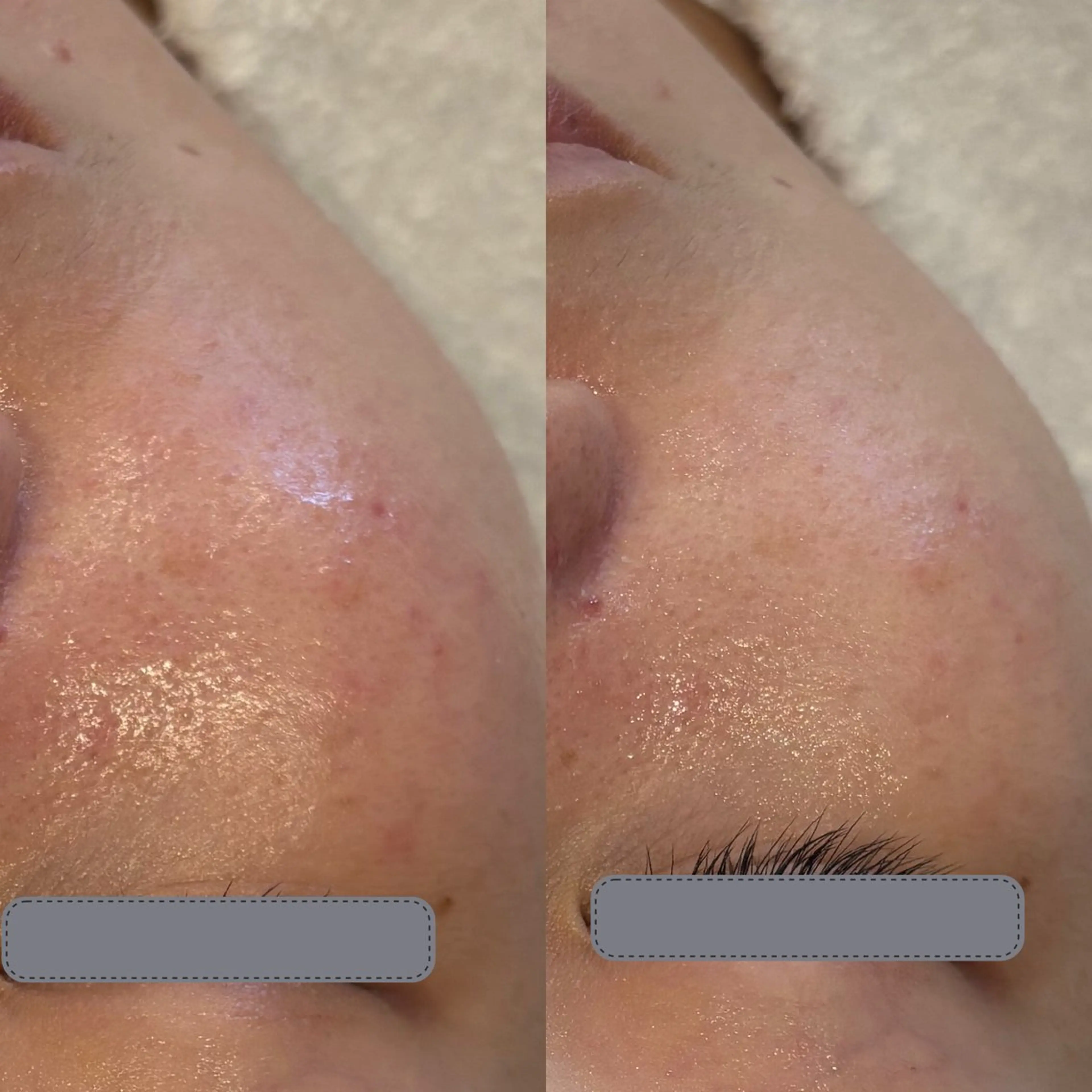 エステ リラク デアイム東広島所属・中井 小春のエステ・リラクイメージ