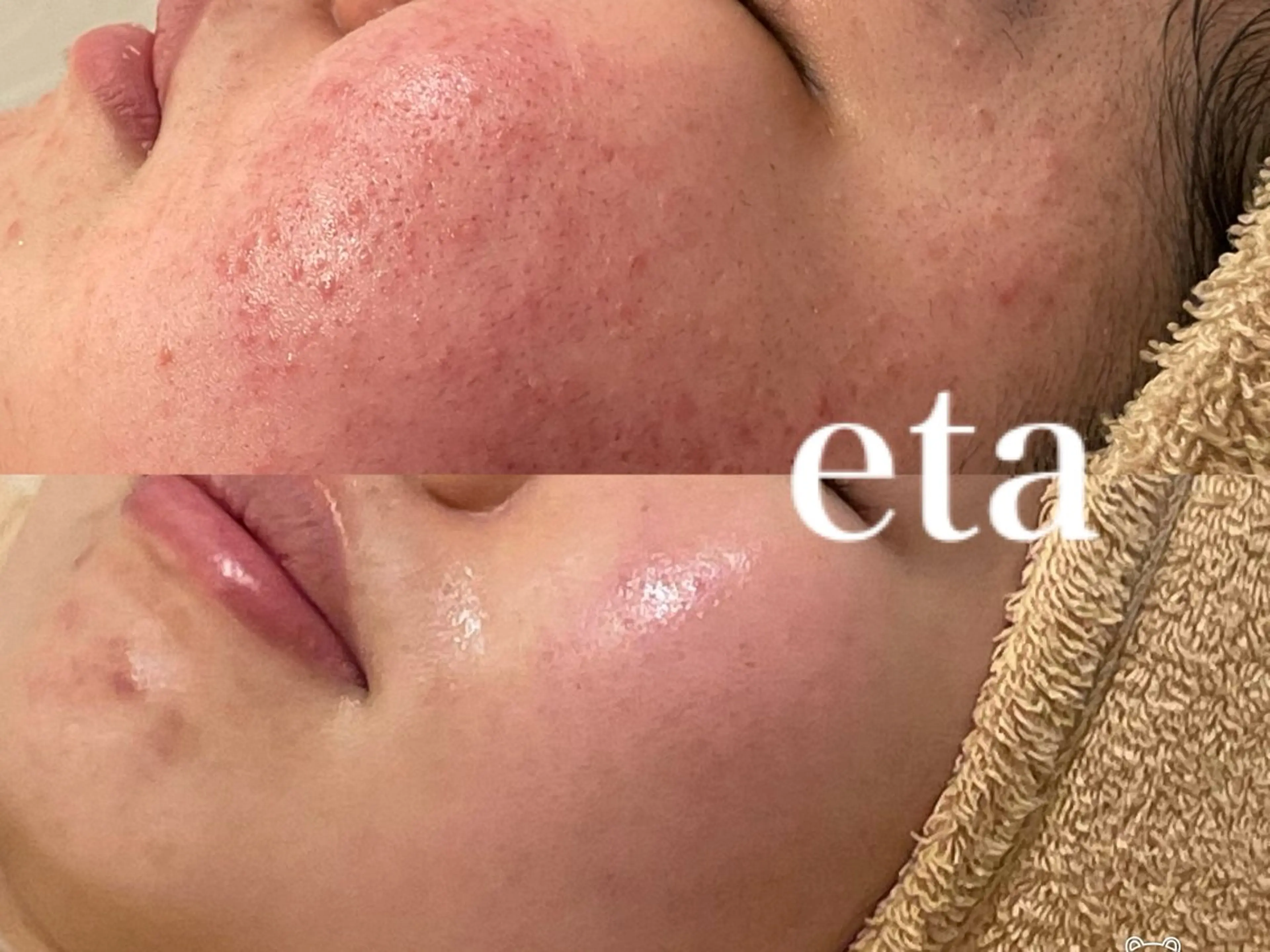 ネイル エステ リラク 💋美ボディサロン eta【エタ】💋のエステ・リラクイメージ