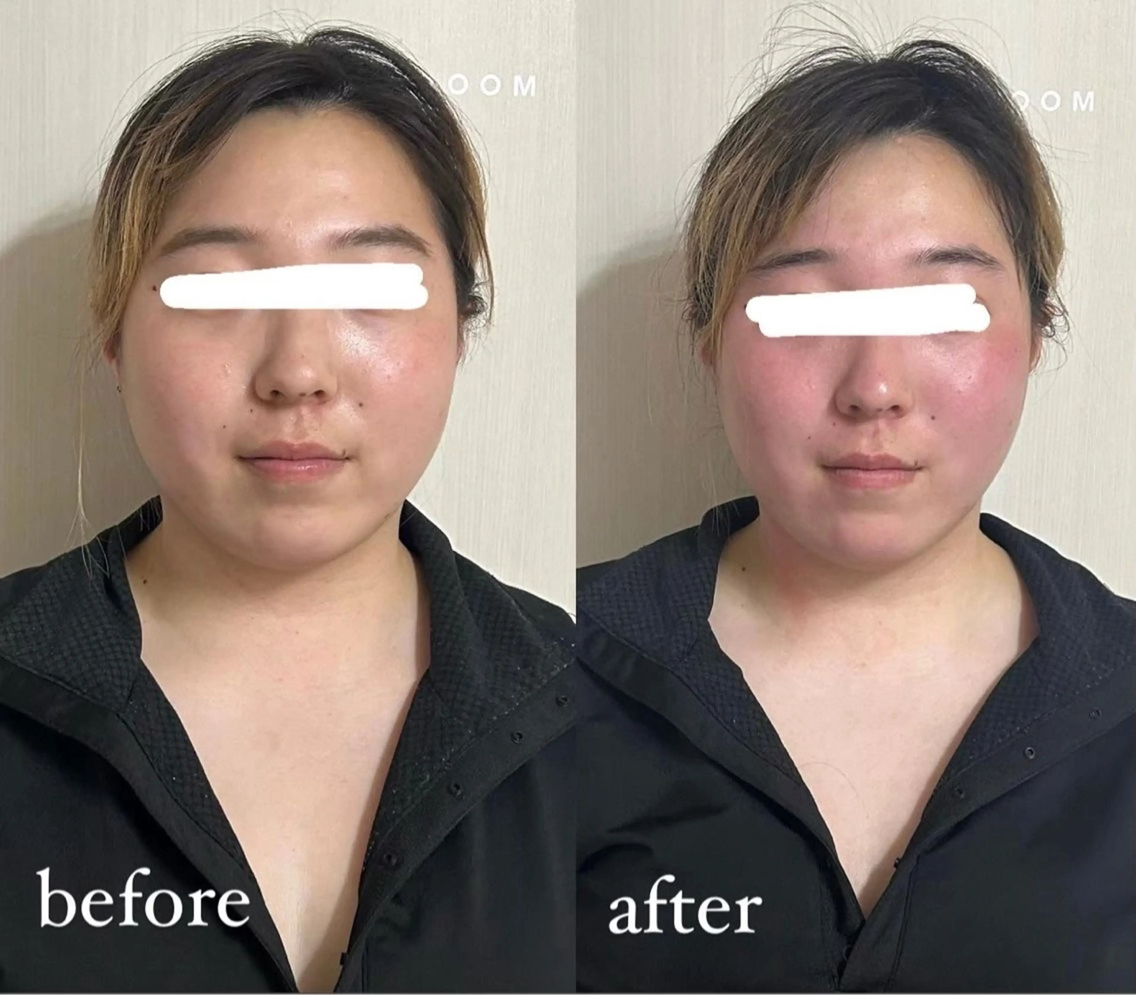 結果重視の温活美容 CARNAのエステ・リラクイメージ