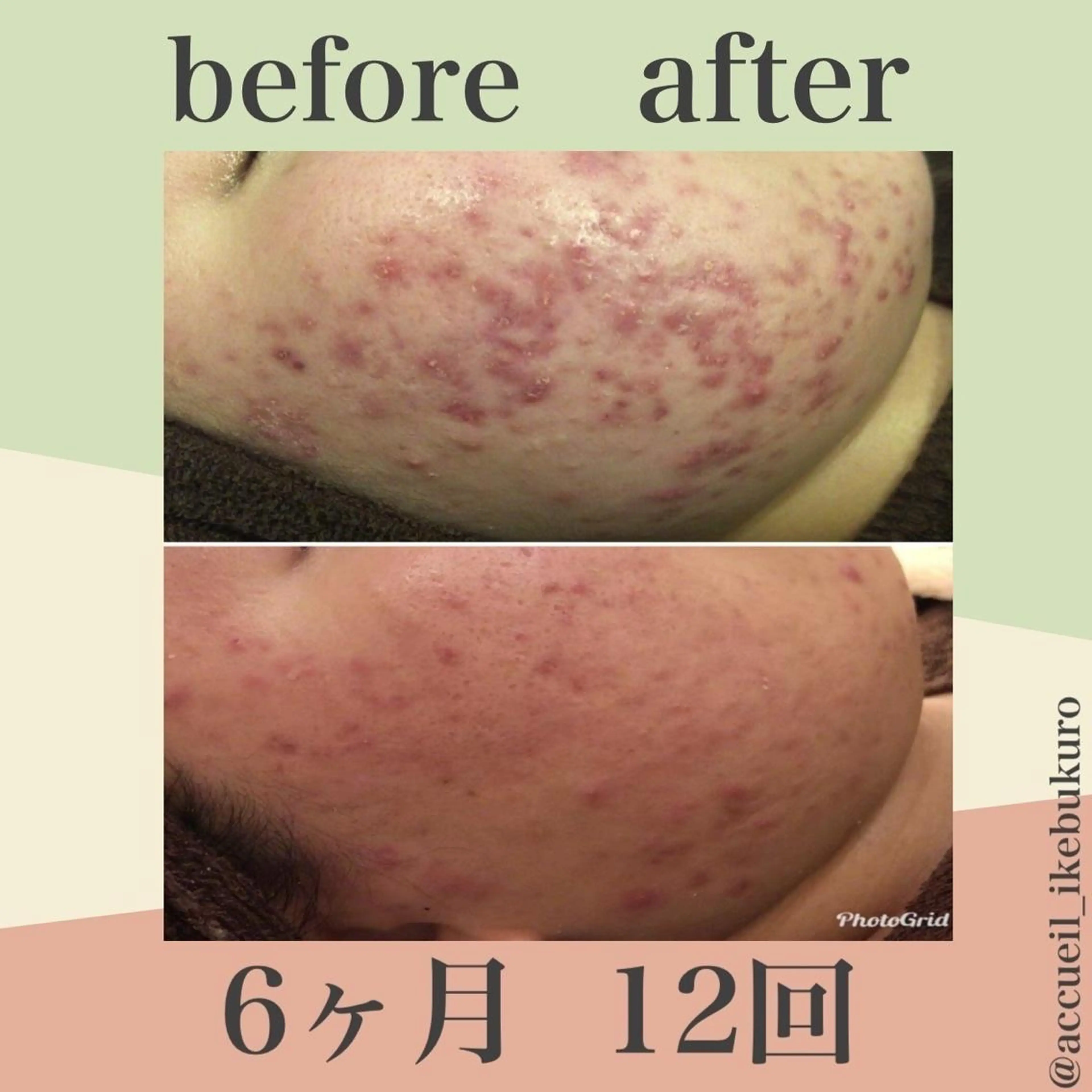 ミディアム カラー パーマ ヘアアレンジ メンズ キッズ ネイル マツエク・マツパ エステ リラク ニキビ・肌質改善専門 ♡人生が変わるサロンのエステ・リラクイメージ