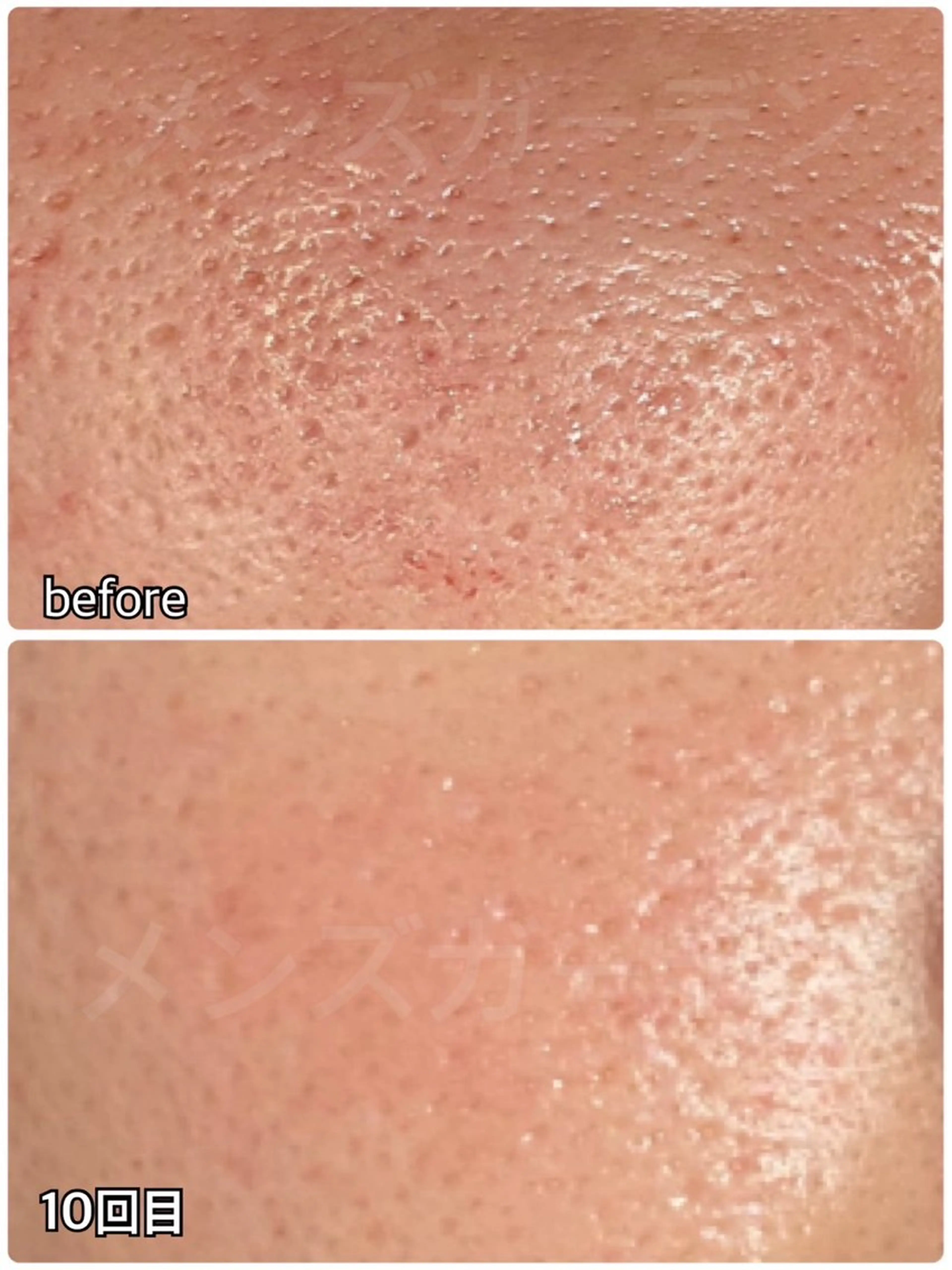 メンズ メンズガーデン今池店所属・メンズガーデン 今池の眉毛・アイブロウイメージ