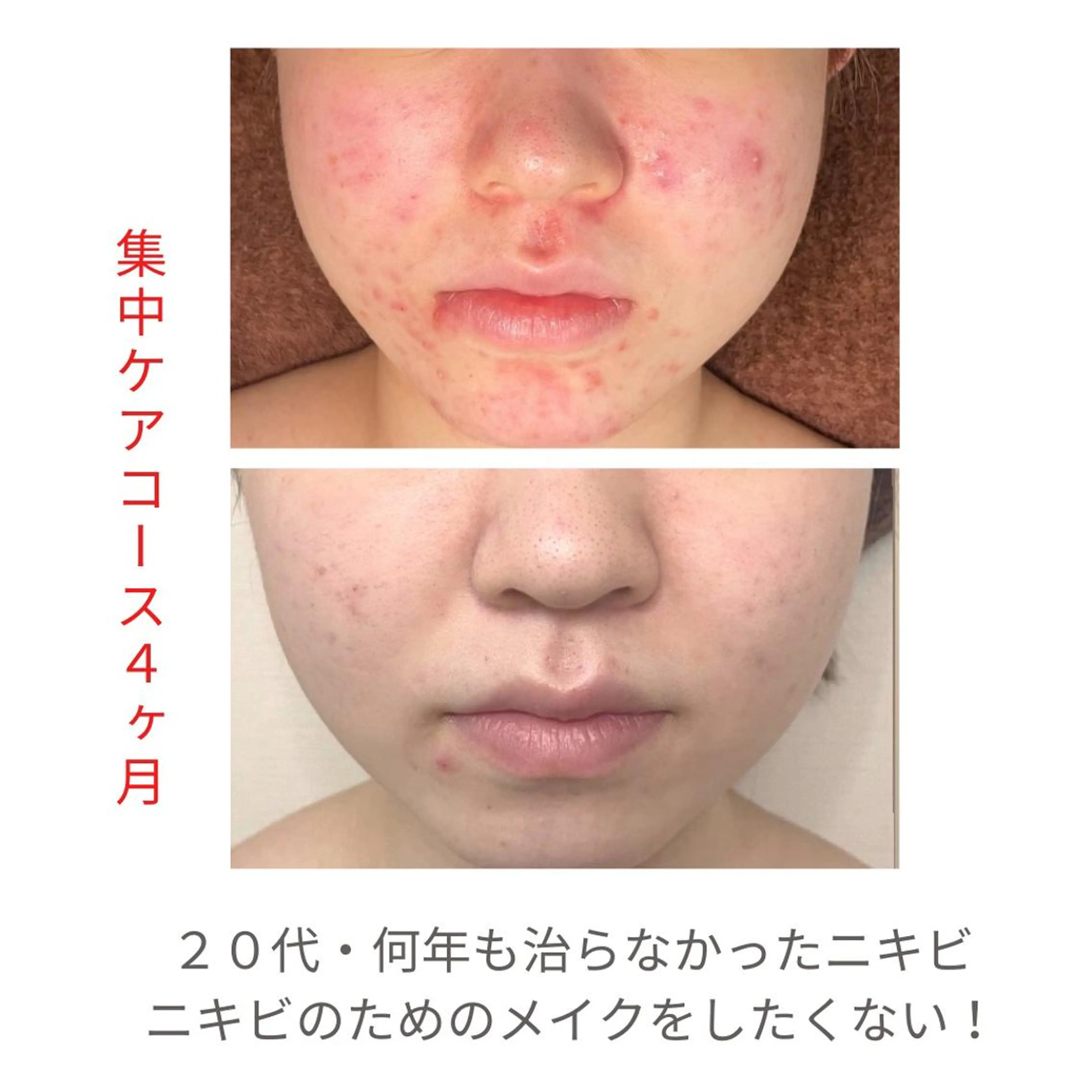 ベラージュ【美背中・ 美尻・フェイシャル】のエステ・リラクイメージ