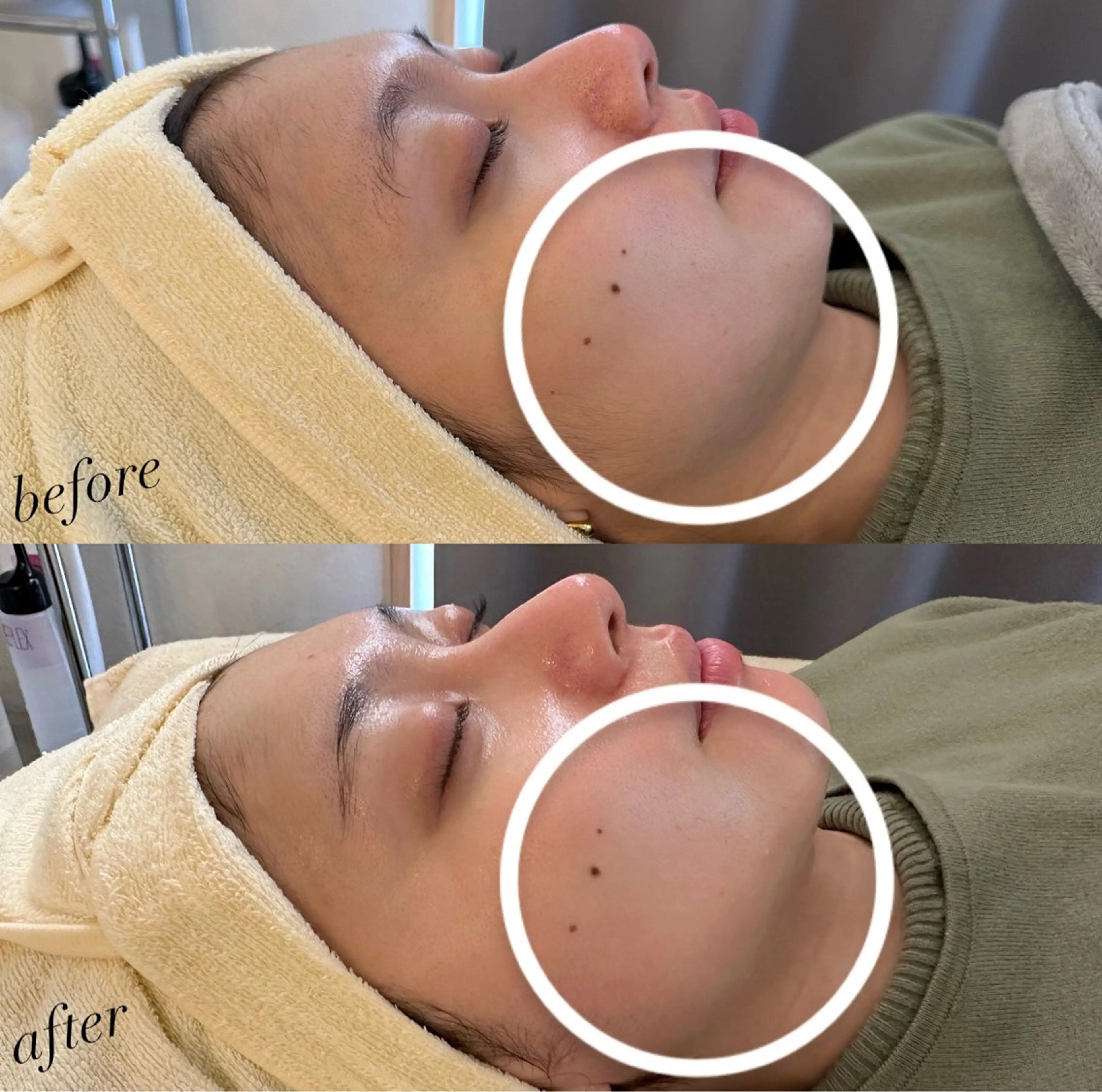 エステ うなじ脱毛/美肌脱毛 LABELのエステ・リラクイメージ