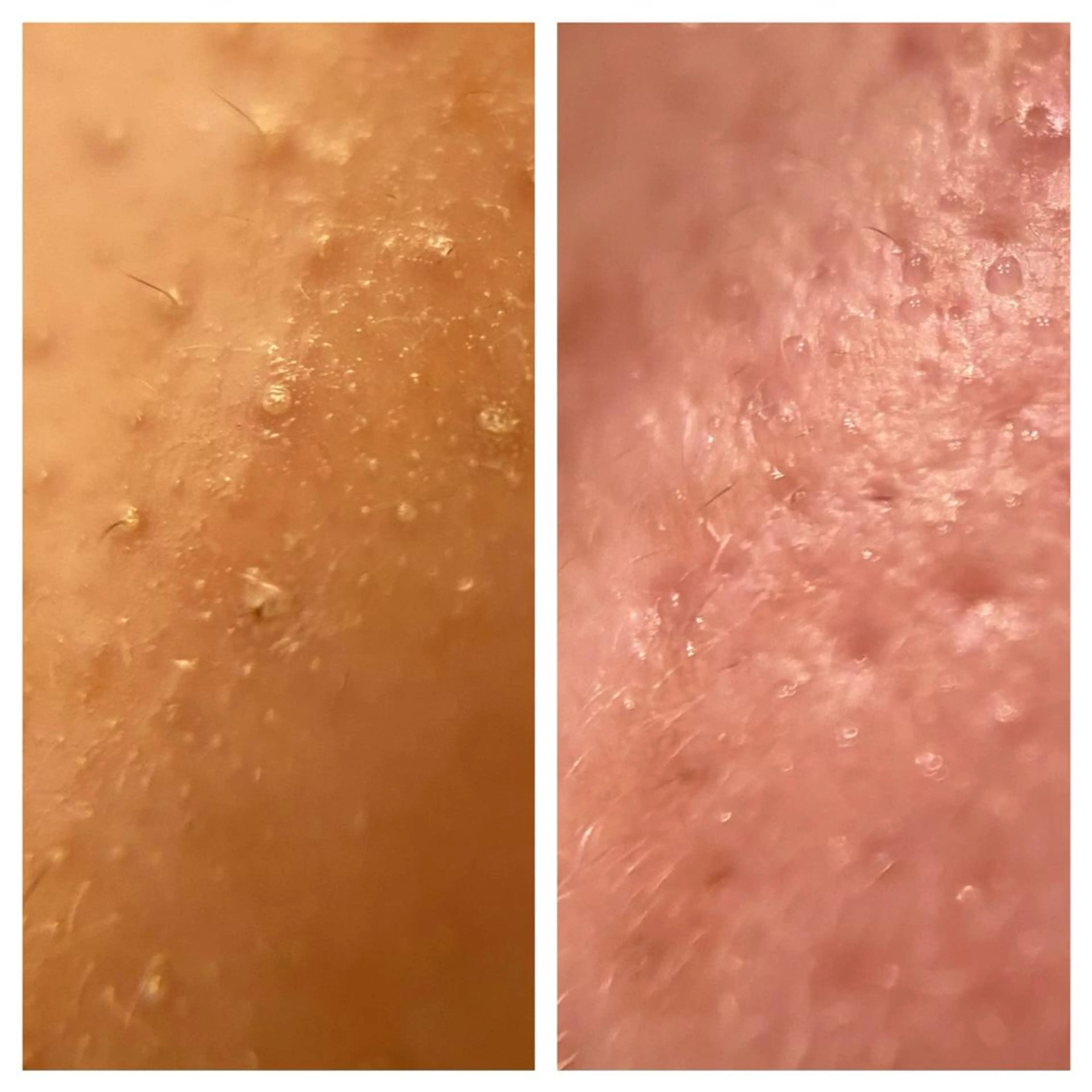 エステ 武藤 千裕のエステ・リラクイメージ