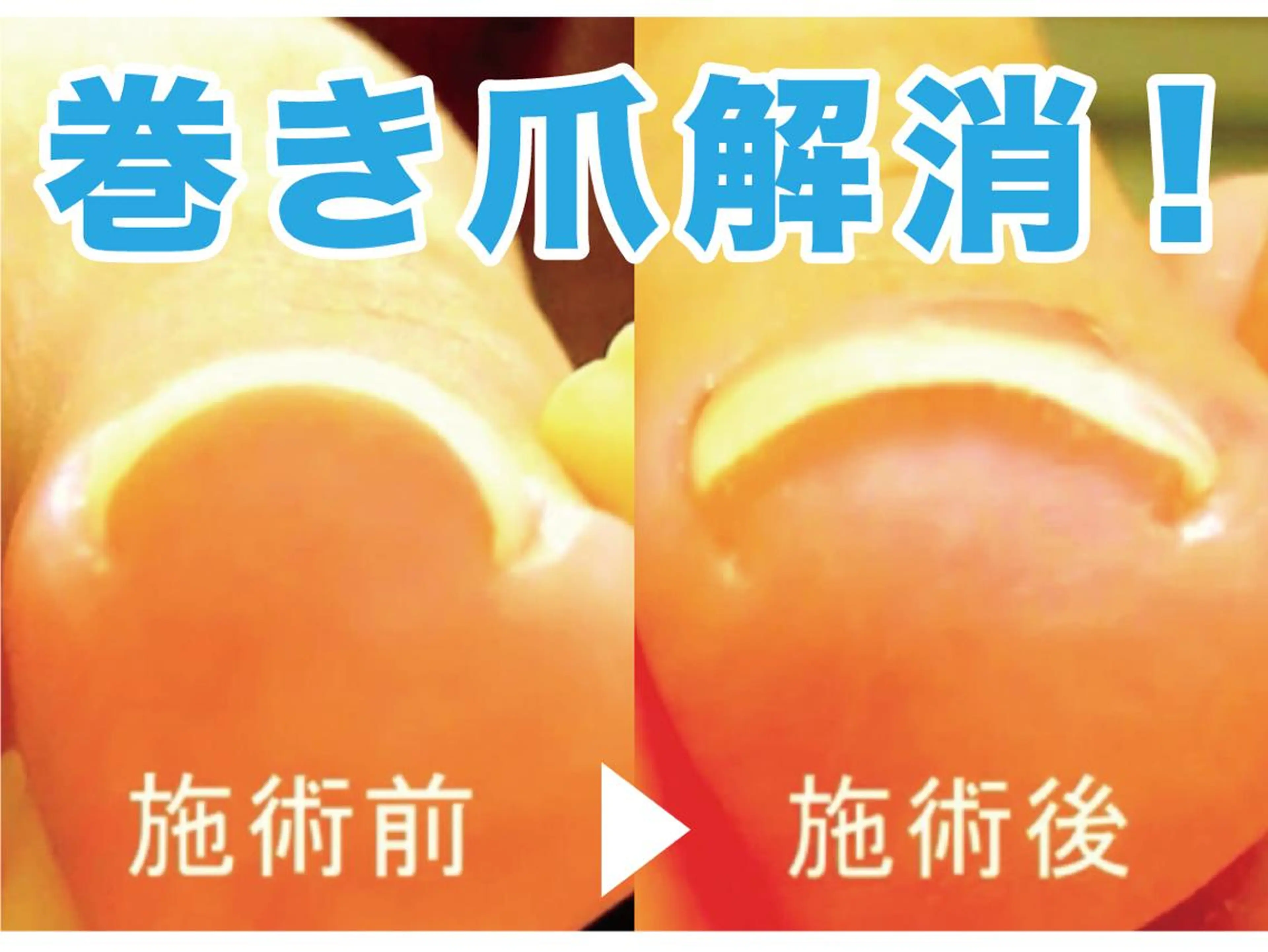 ネイル Bliss EyeLash & Beauty所属・Bliss(ブリス) NEA協会認定校のネイルデザイン