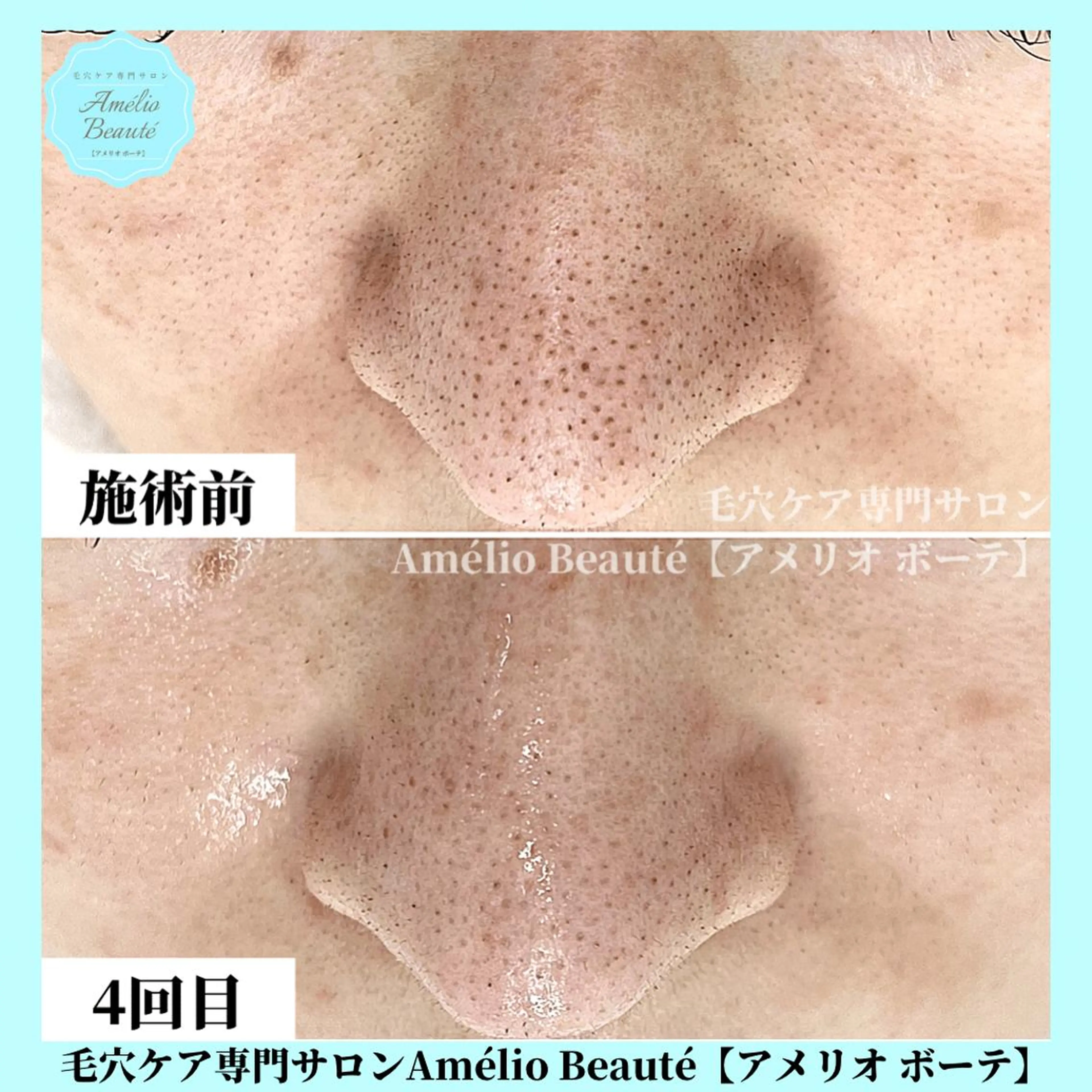毛穴ケア専門サロン Amélio Beauté所属・毛穴ケア専門サロン アメリオボーテのその他イメージ