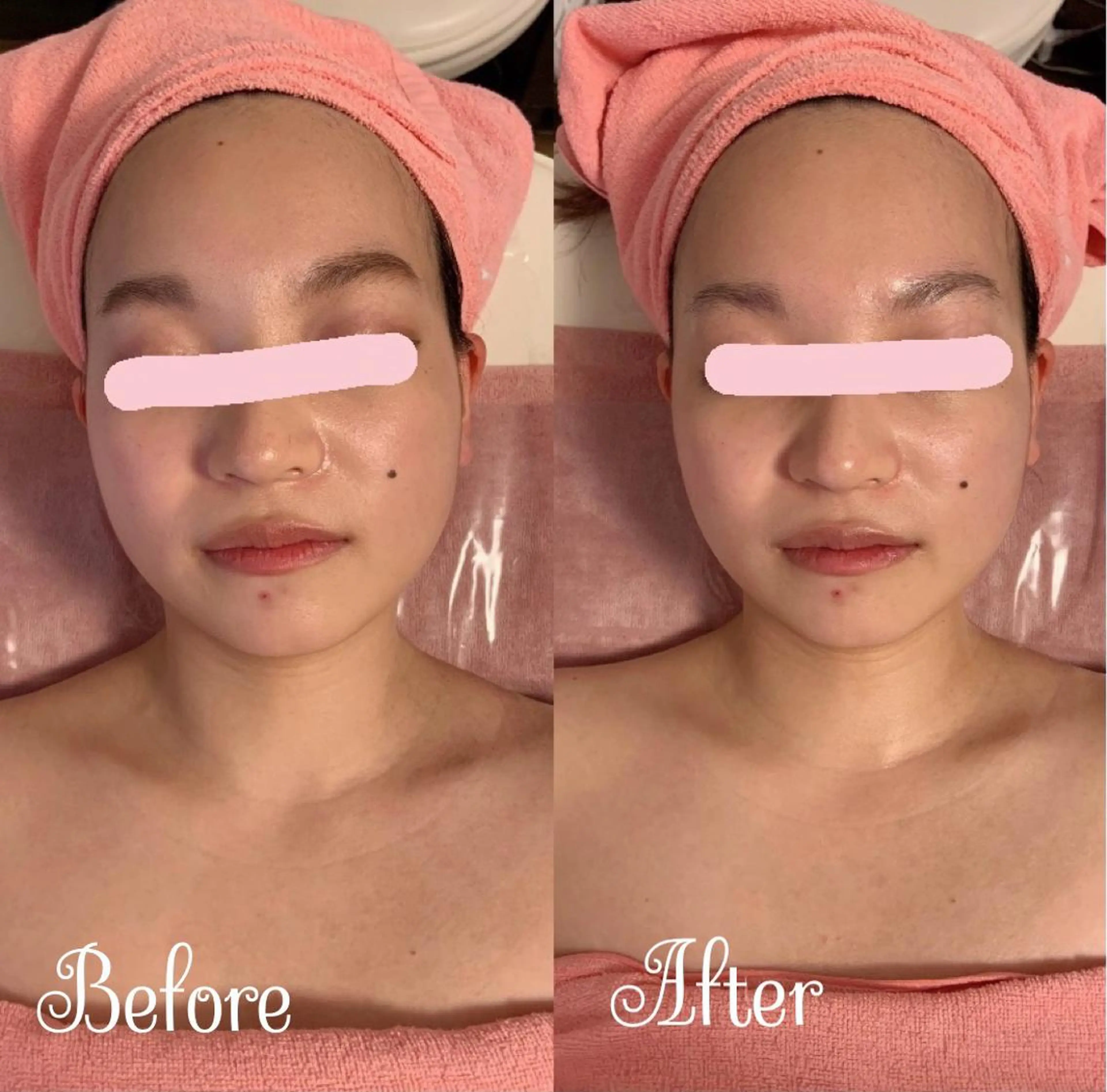 透明感の肌Lino malieのエステ・リラクイメージ