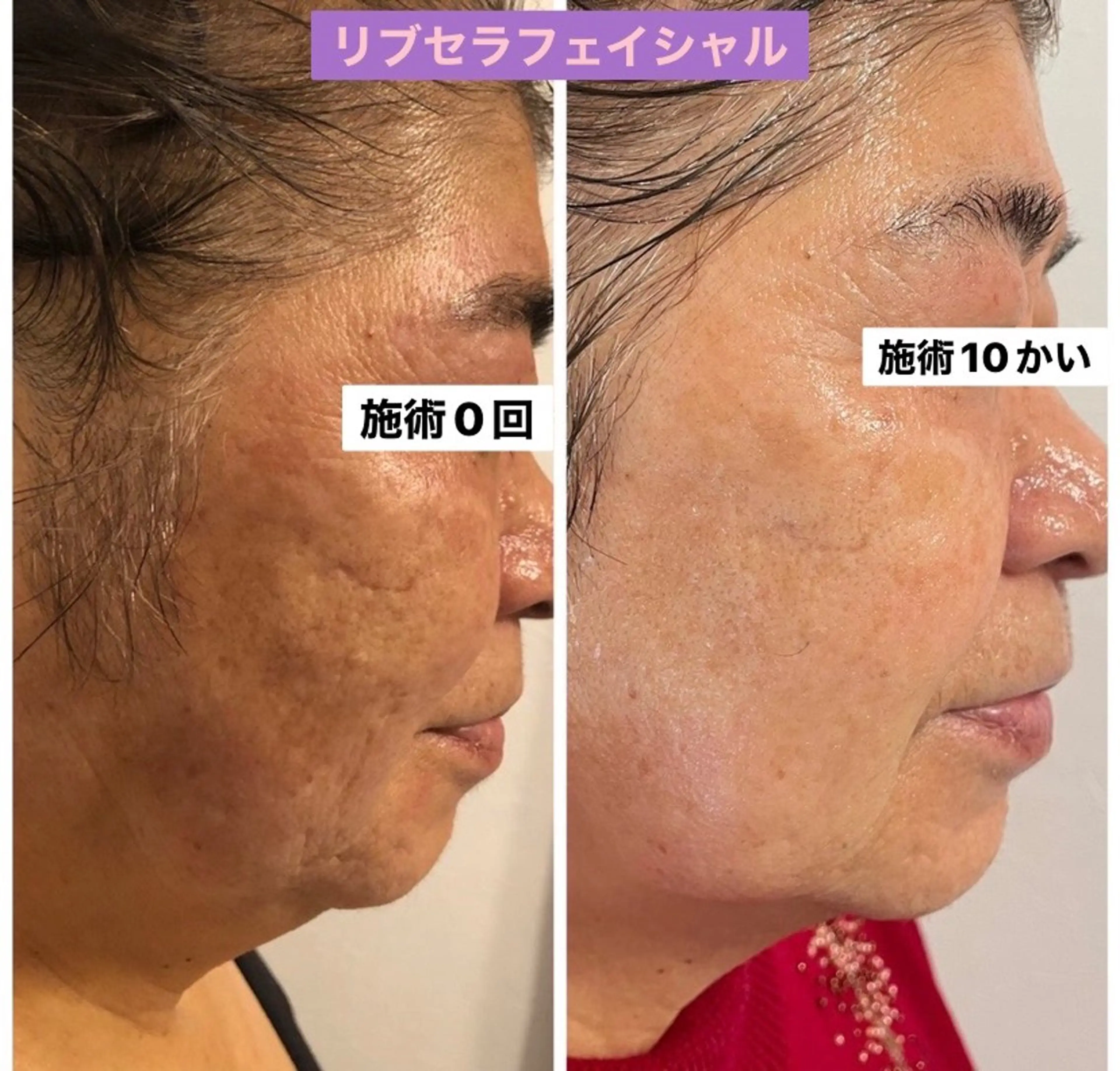 エステ Private Salon Prunelle所属・プライベートサロン プリュネルのエステ・リラクイメージ