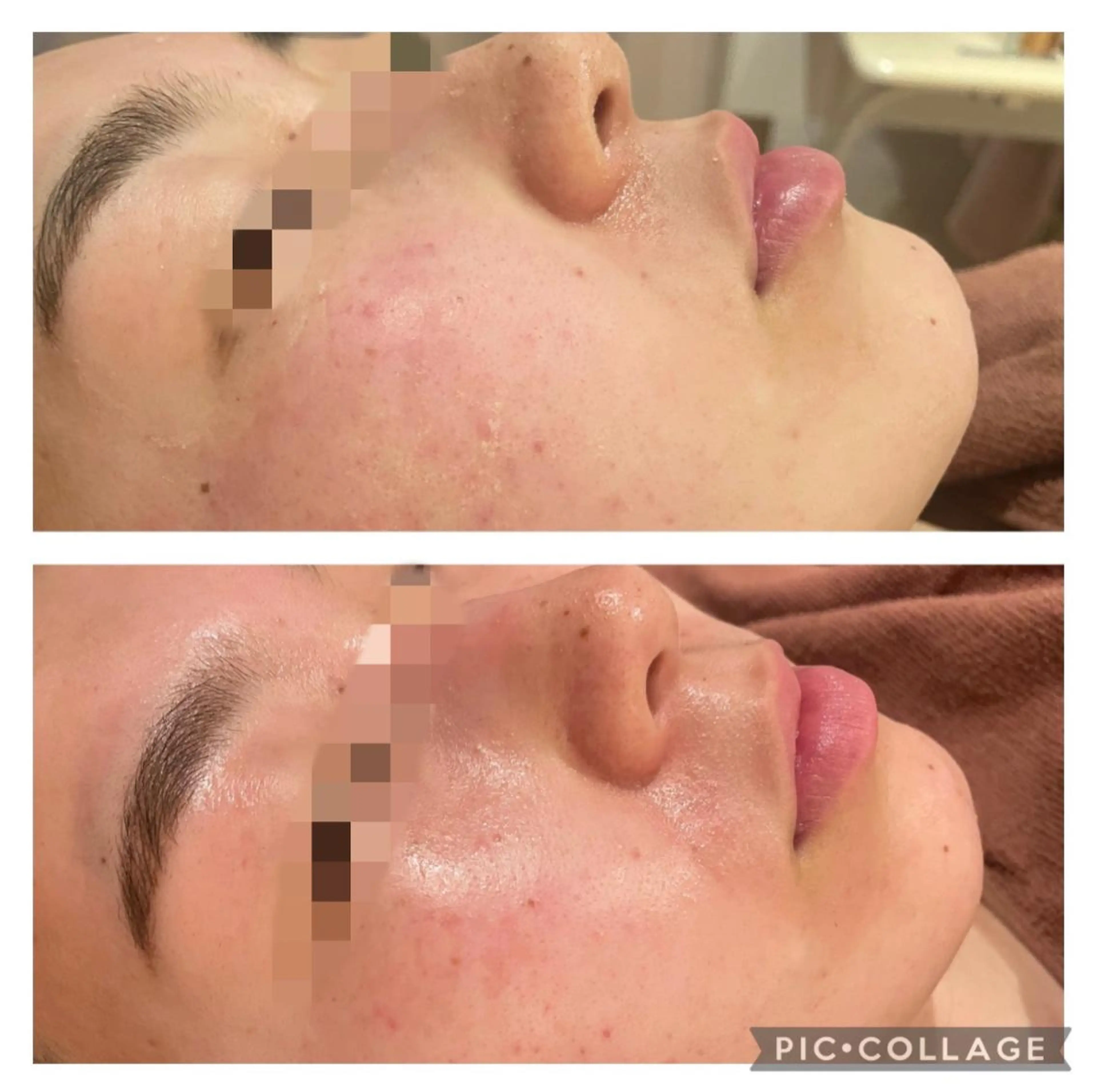 セミロング カラー パーマ ヘアアレンジ メンズ キッズ ネイル マツエク・マツパ アイブロウ エステ リラク ニキビ特化型エステ 🍓最短で肌質改善のその他イメージ