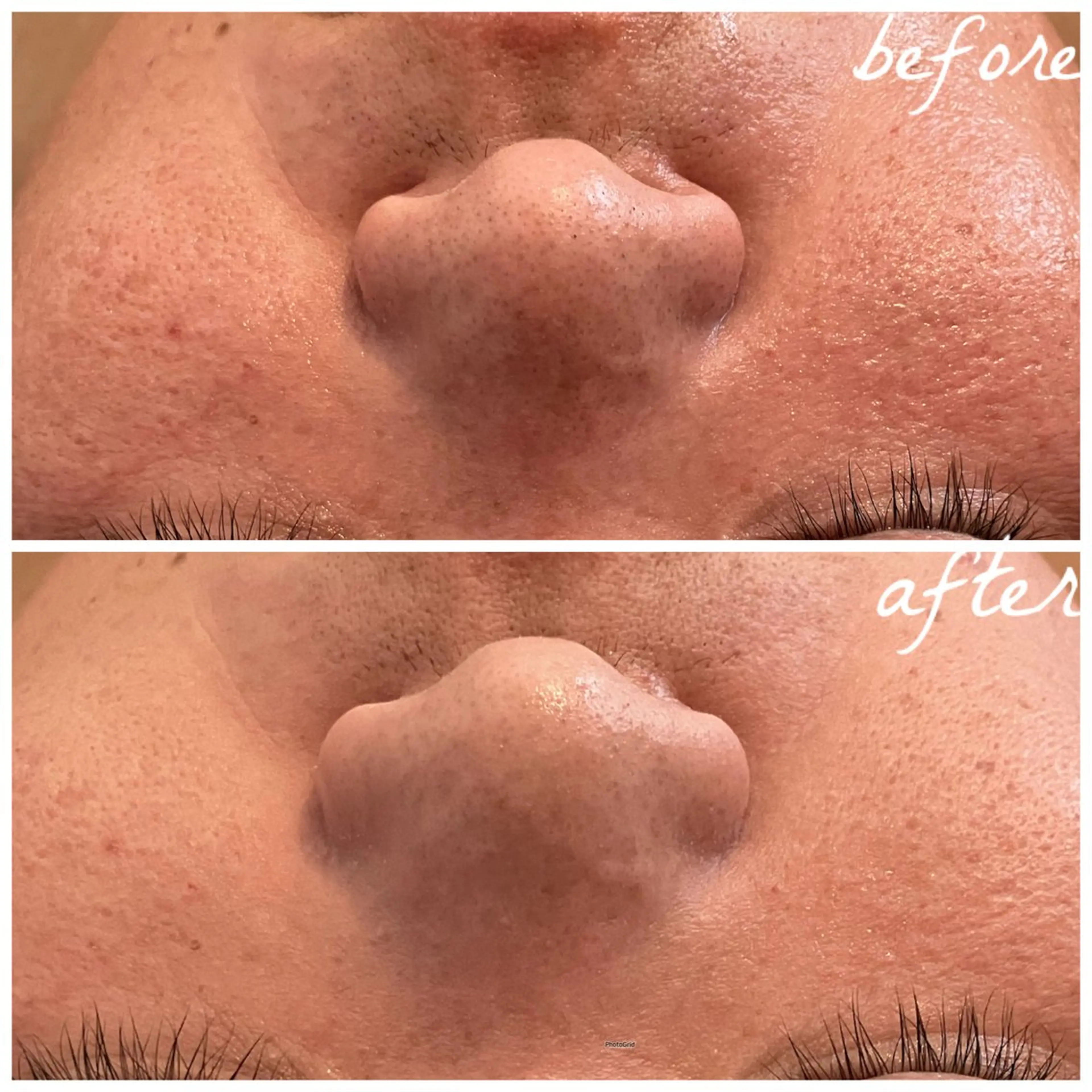 メンズ メナード岐阜茜部 杉浦のエステ・リラクイメージ