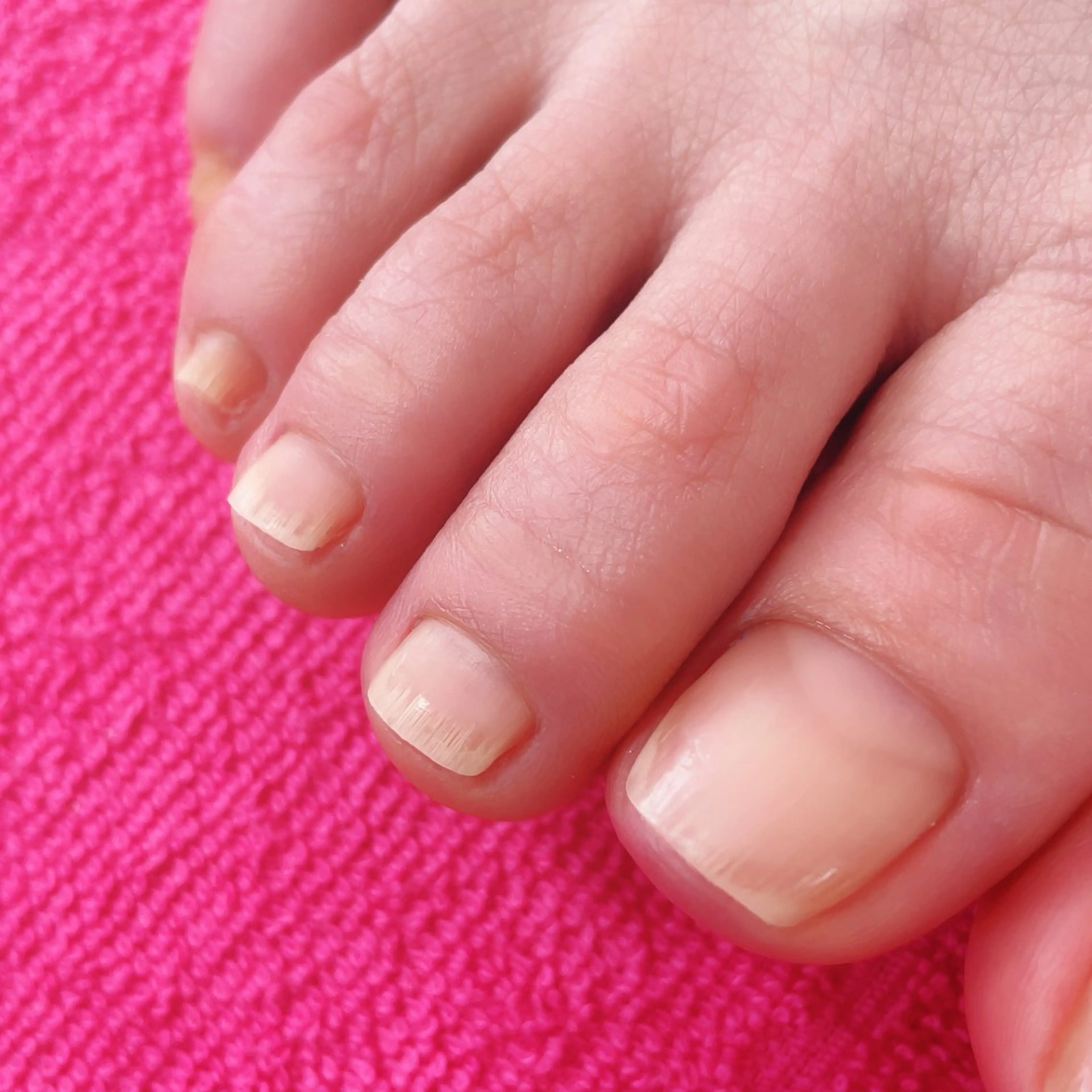 ネイル オフのみ(ネイル) かかと角質ケア opal所属・樫村 美波のネイルデザイン