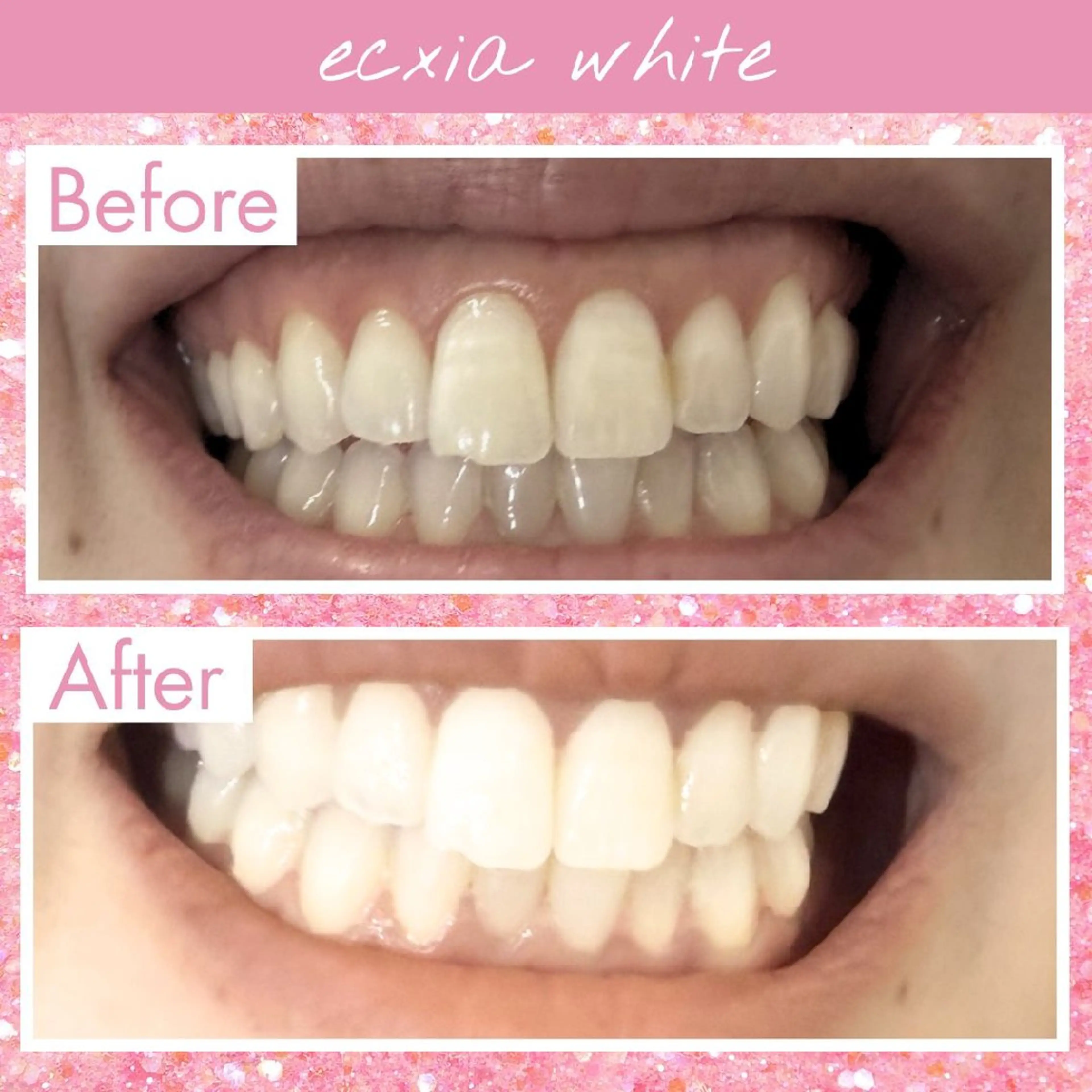 セルフホワイトニングエクシアホワイト草加店所属・セルフホワイトニング エクシア草加店のその他イメージ