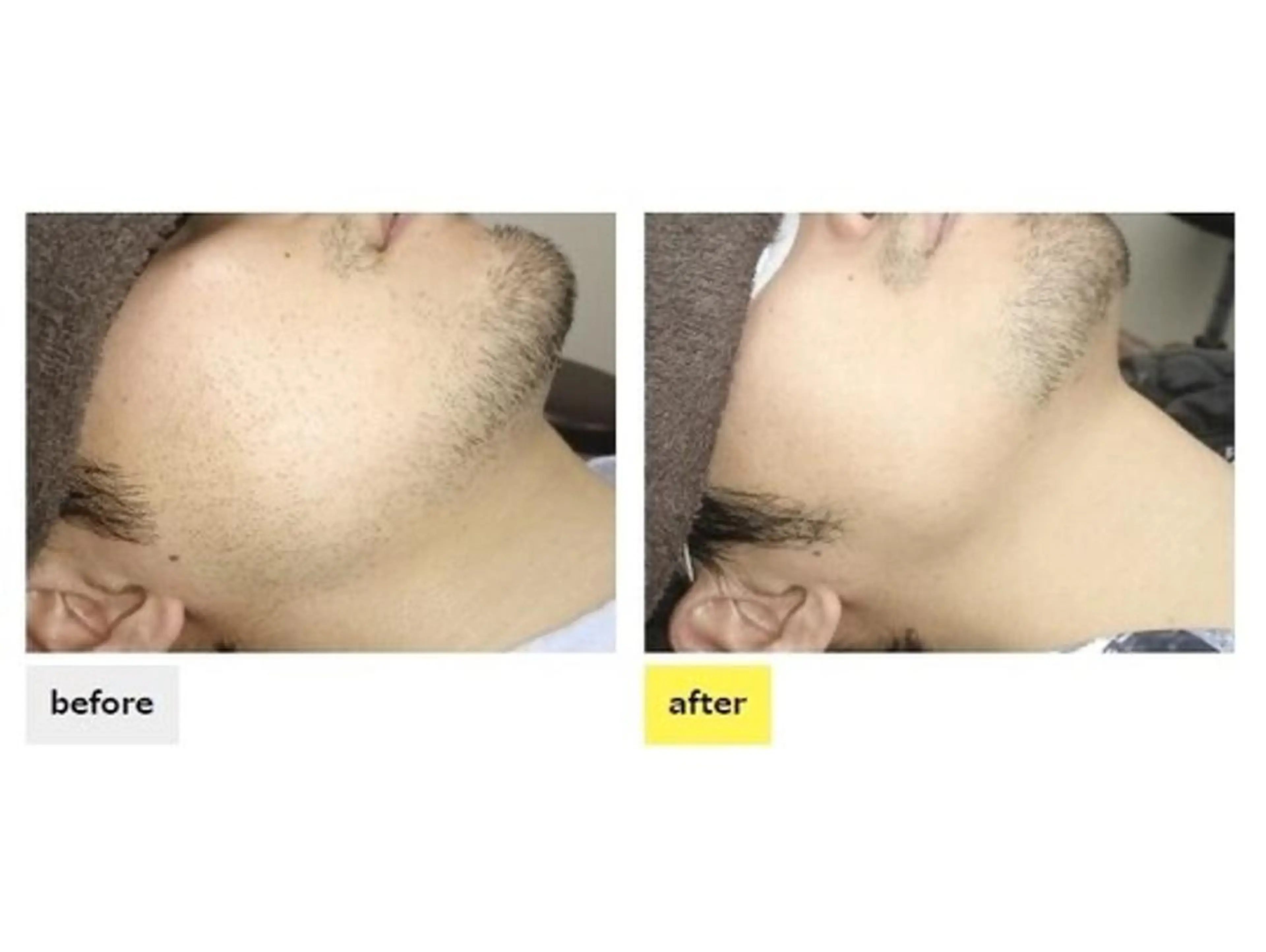 メンズ 都度払い脱毛⭐️ 脱毛サロンMIRACのエステ・リラクイメージ