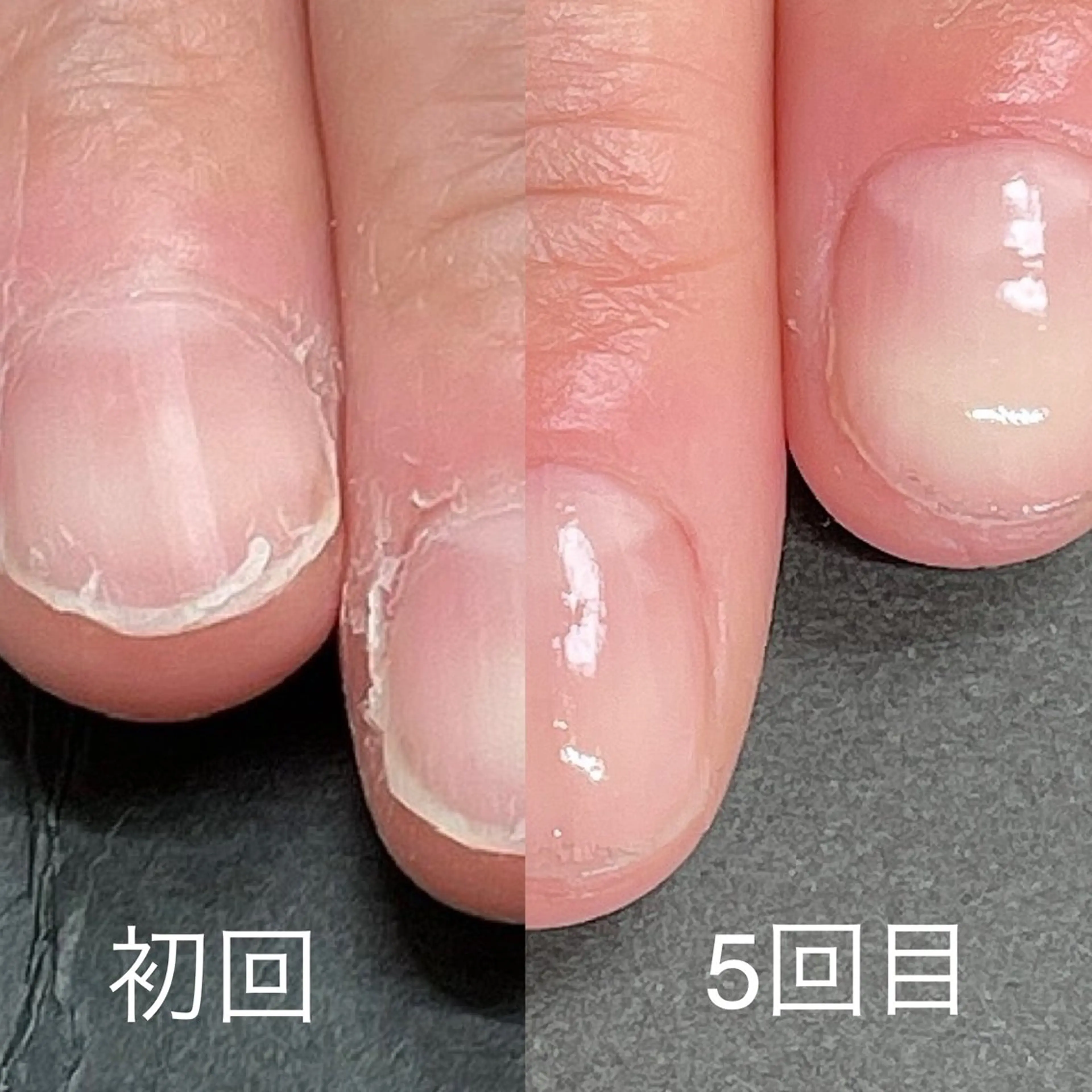 ネイル ハンドケア 関山 志乃のネイルデザイン