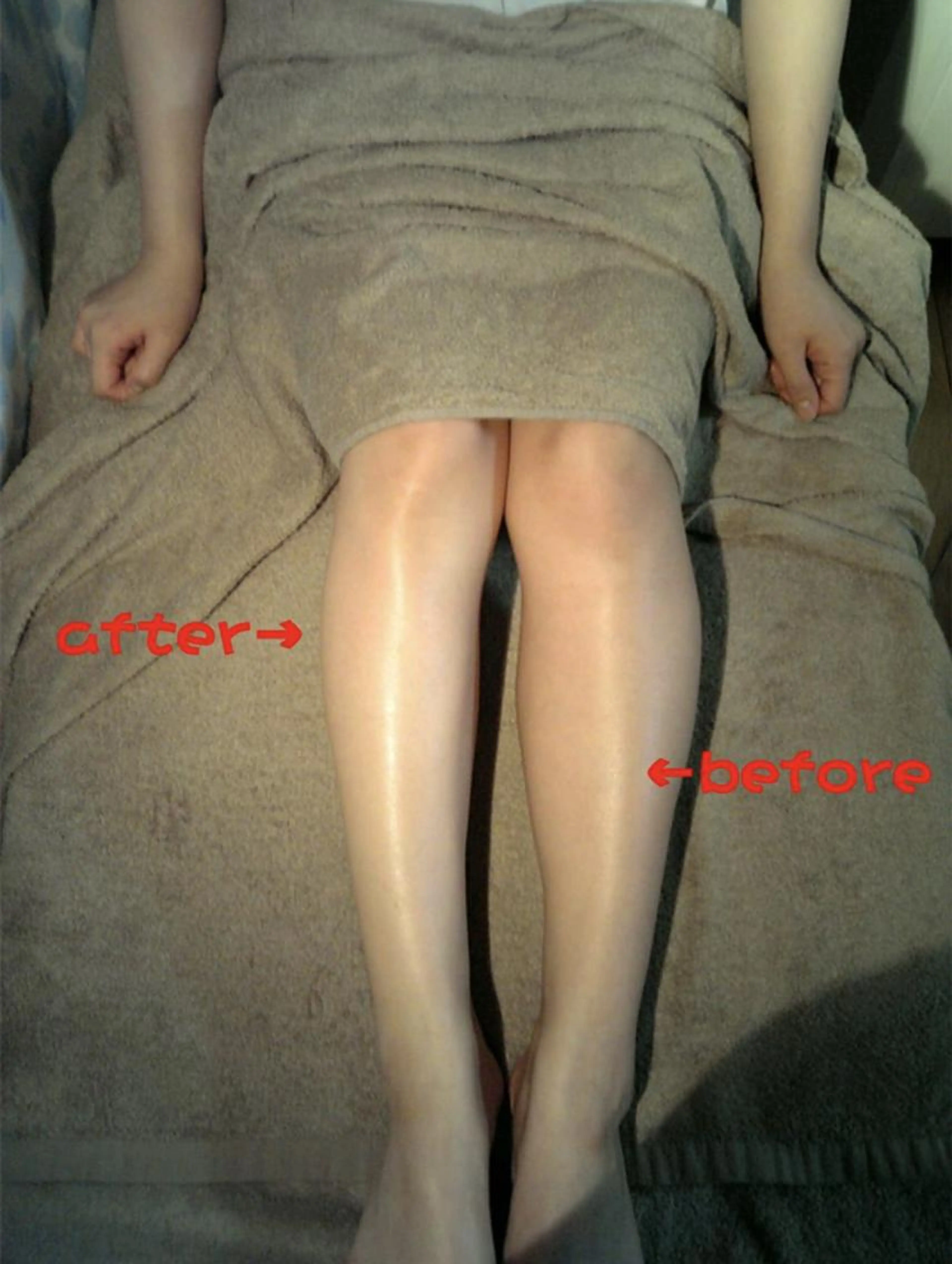 <B都度払+無勧誘>セルライトケア+O脚矯正+EMS筋トレ=135分25,300→9900の写真