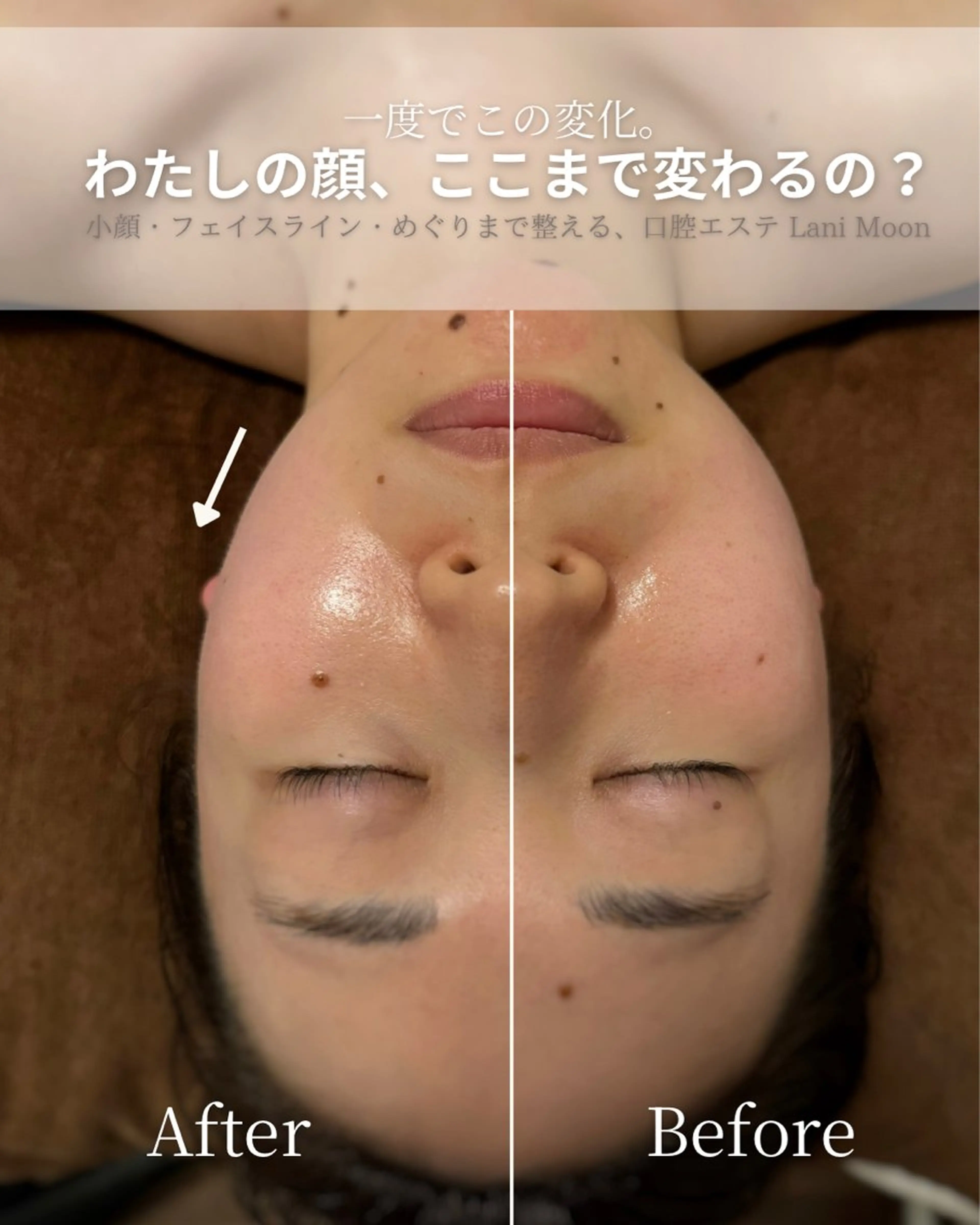 Lani Moon所属・⟡ 京都 小顔  ⊹ Lani Moonのエステ・リラクイメージ