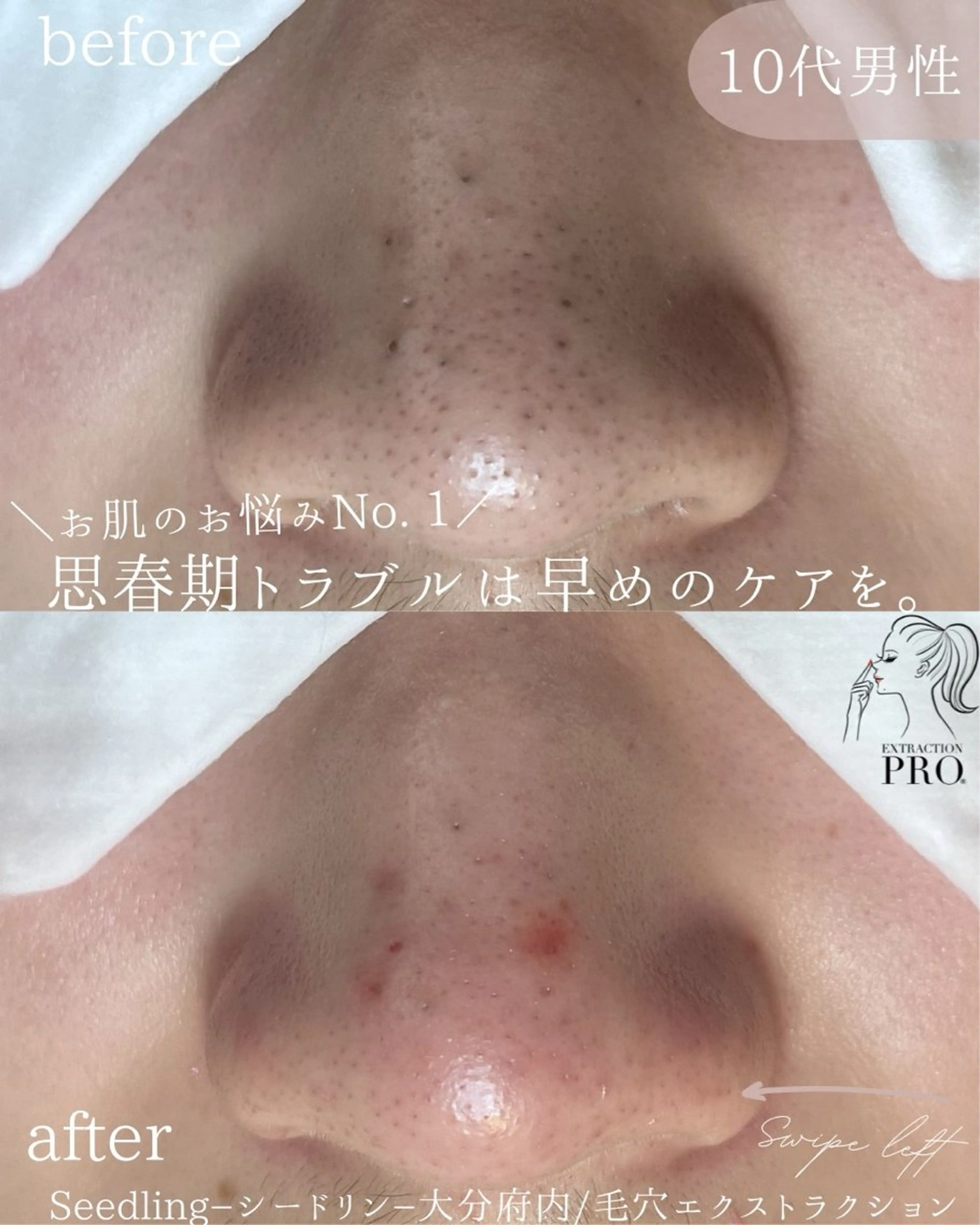 エステ シードリン 府内店 小波のヘアスタイル