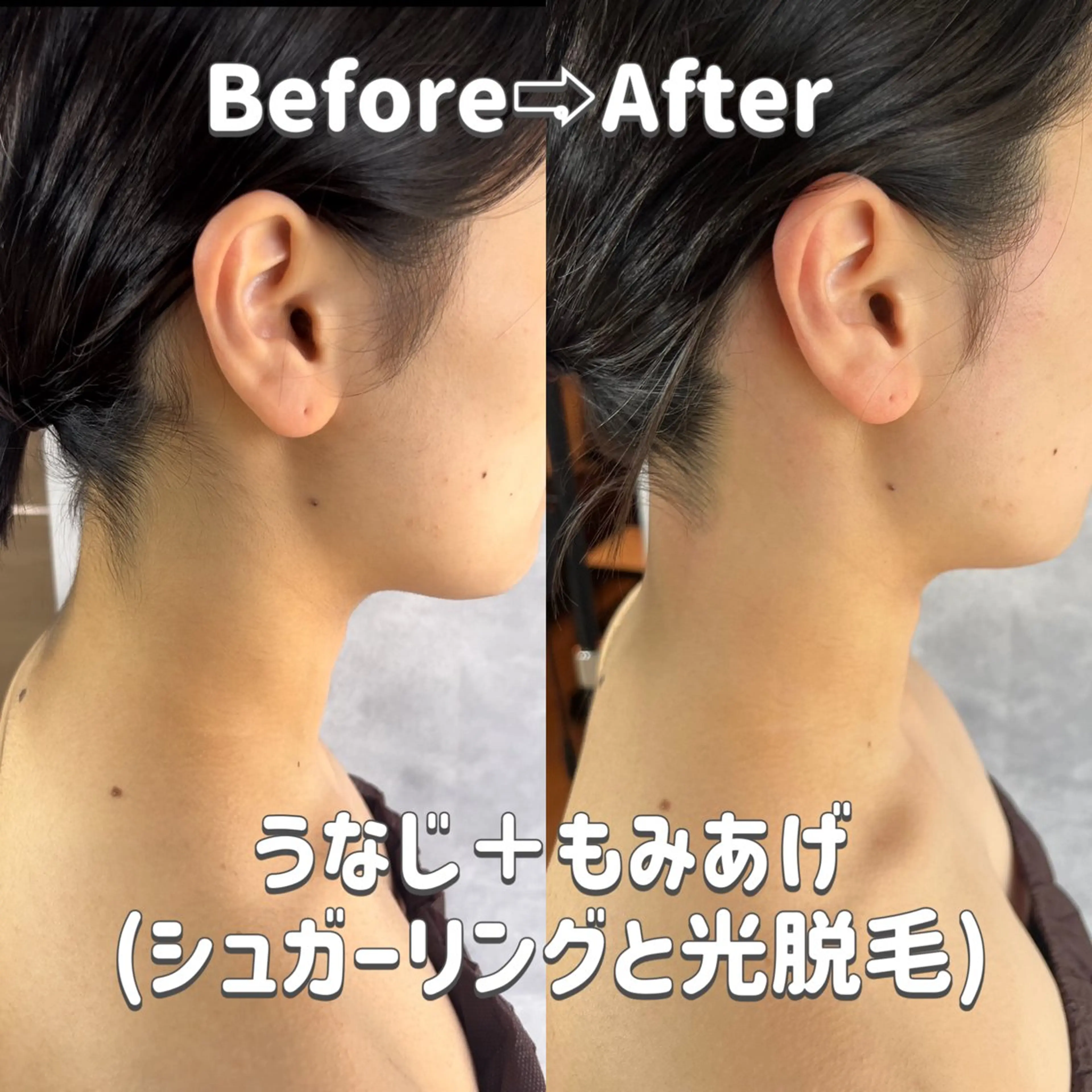 うなじラボ(UNAJI LABO)所属・池袋脱毛 さとうのエステ・リラクイメージ