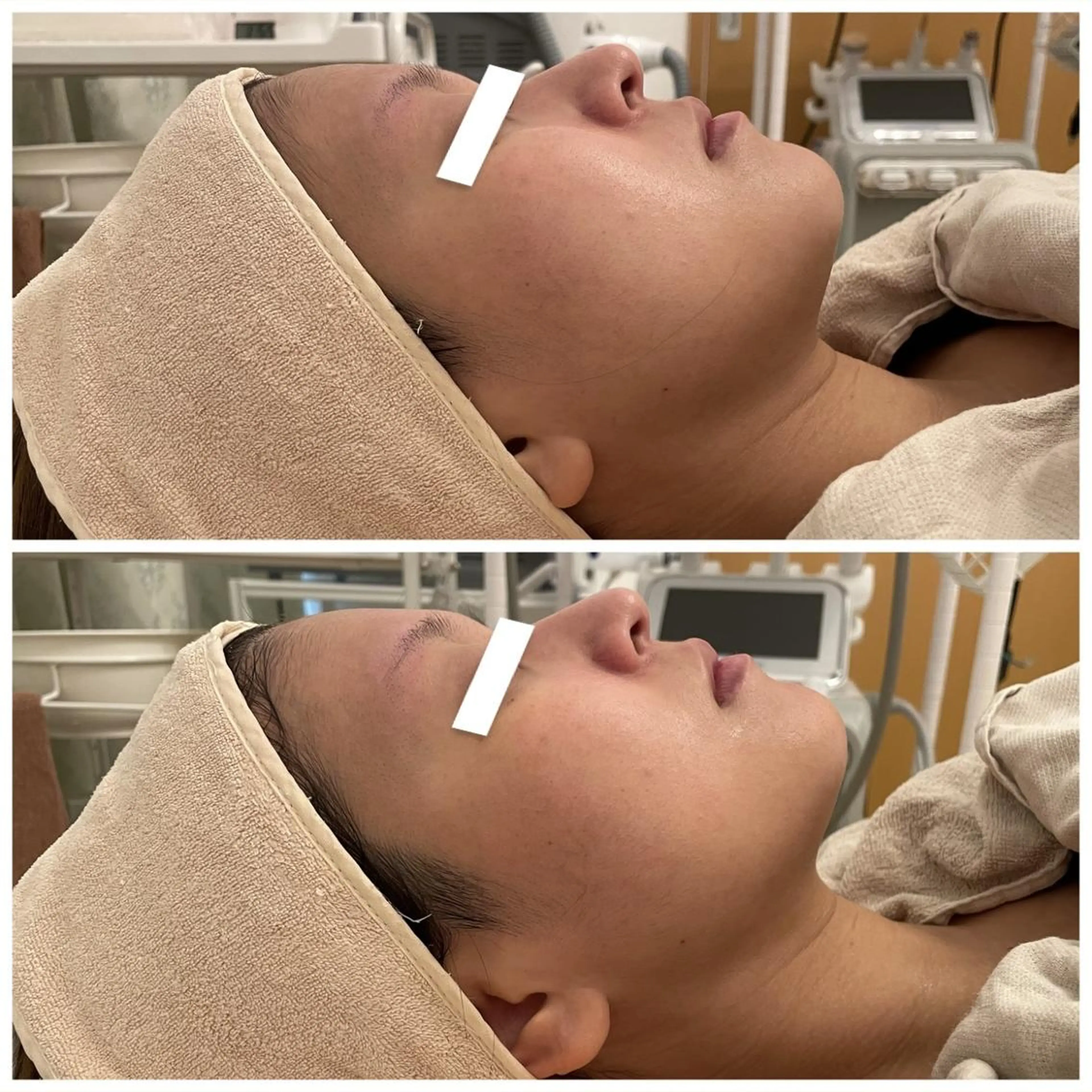 ✨美肌水光✨ アトリエリュバンのエステ・リラクイメージ