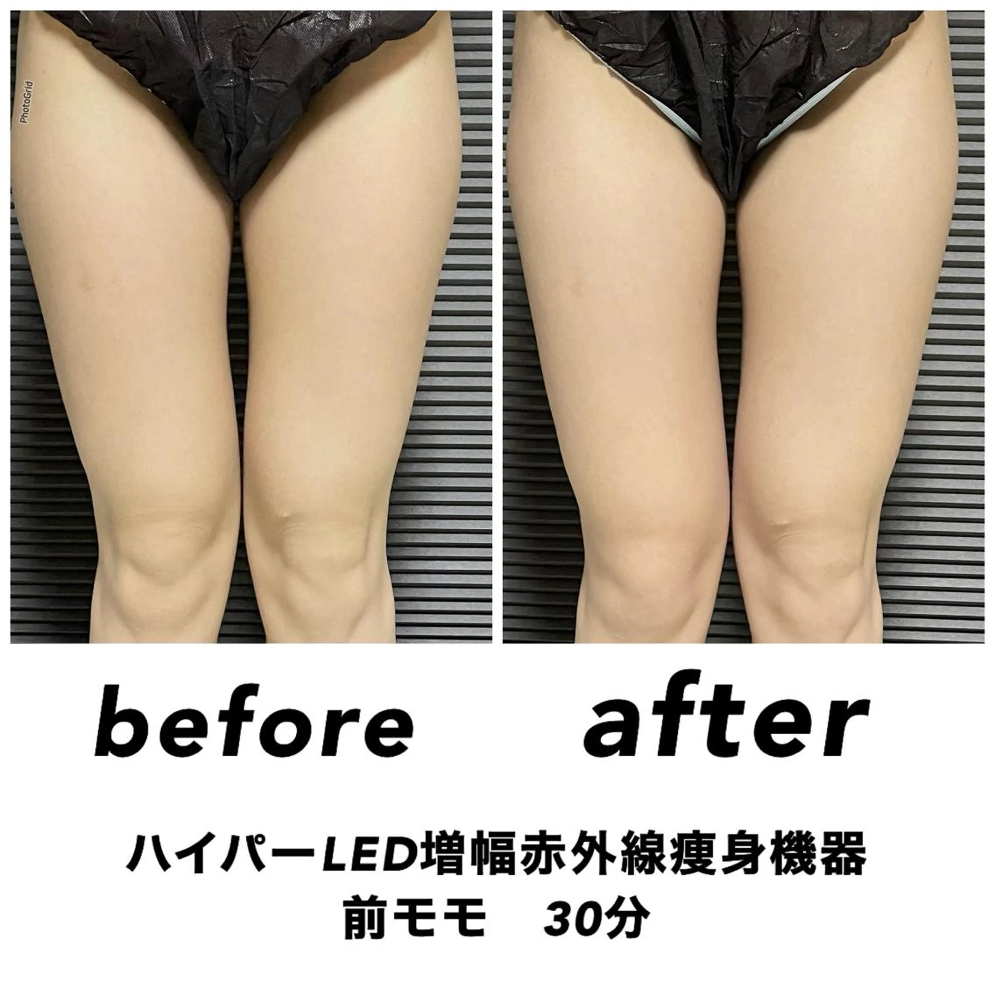 エステ ネイル・エステサロンUILANI所属・ネイル・エステサロン UILANIのネイルデザイン