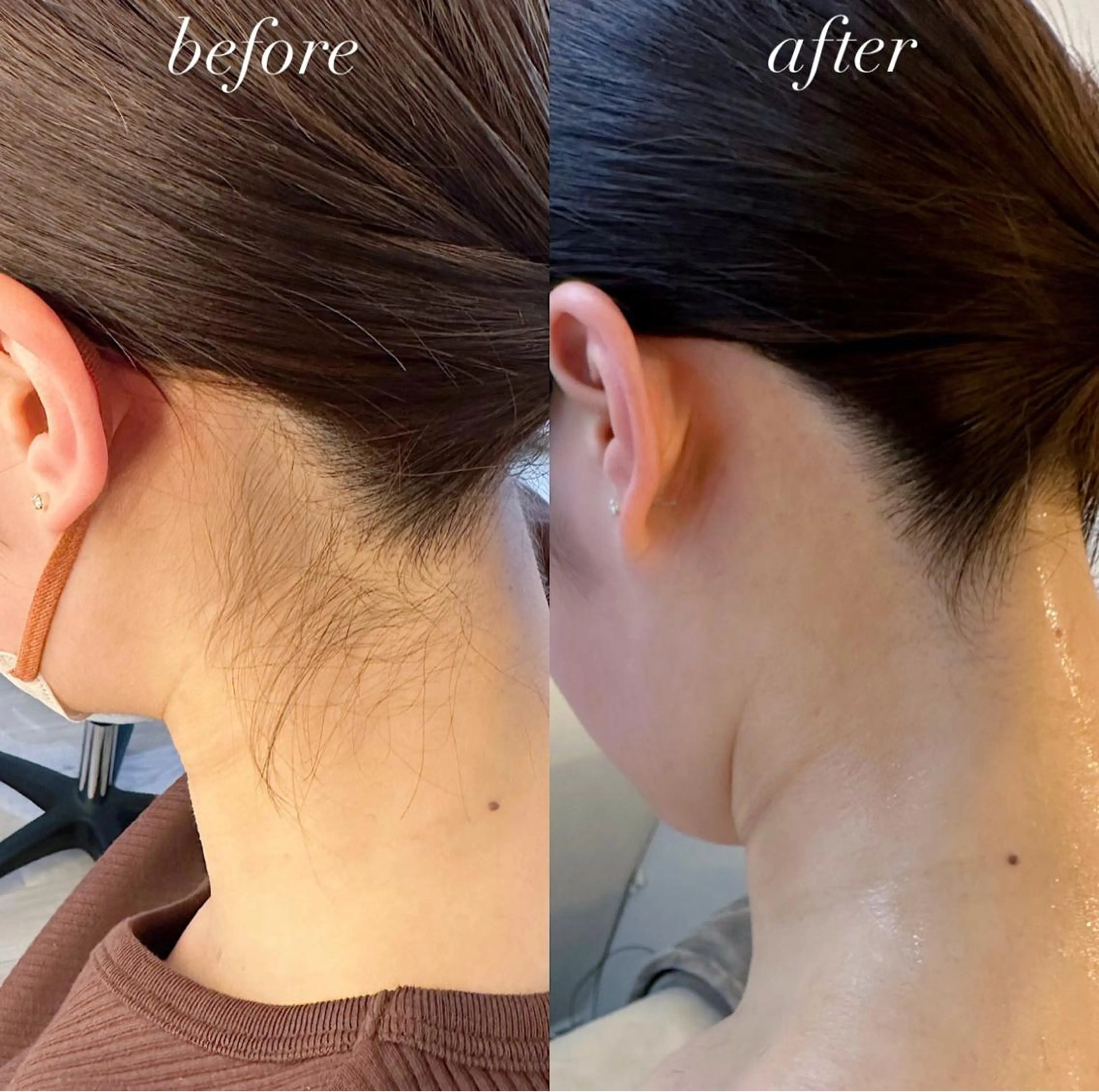 うなじ脱毛/美肌脱毛 LABELのエステ・リラクイメージ