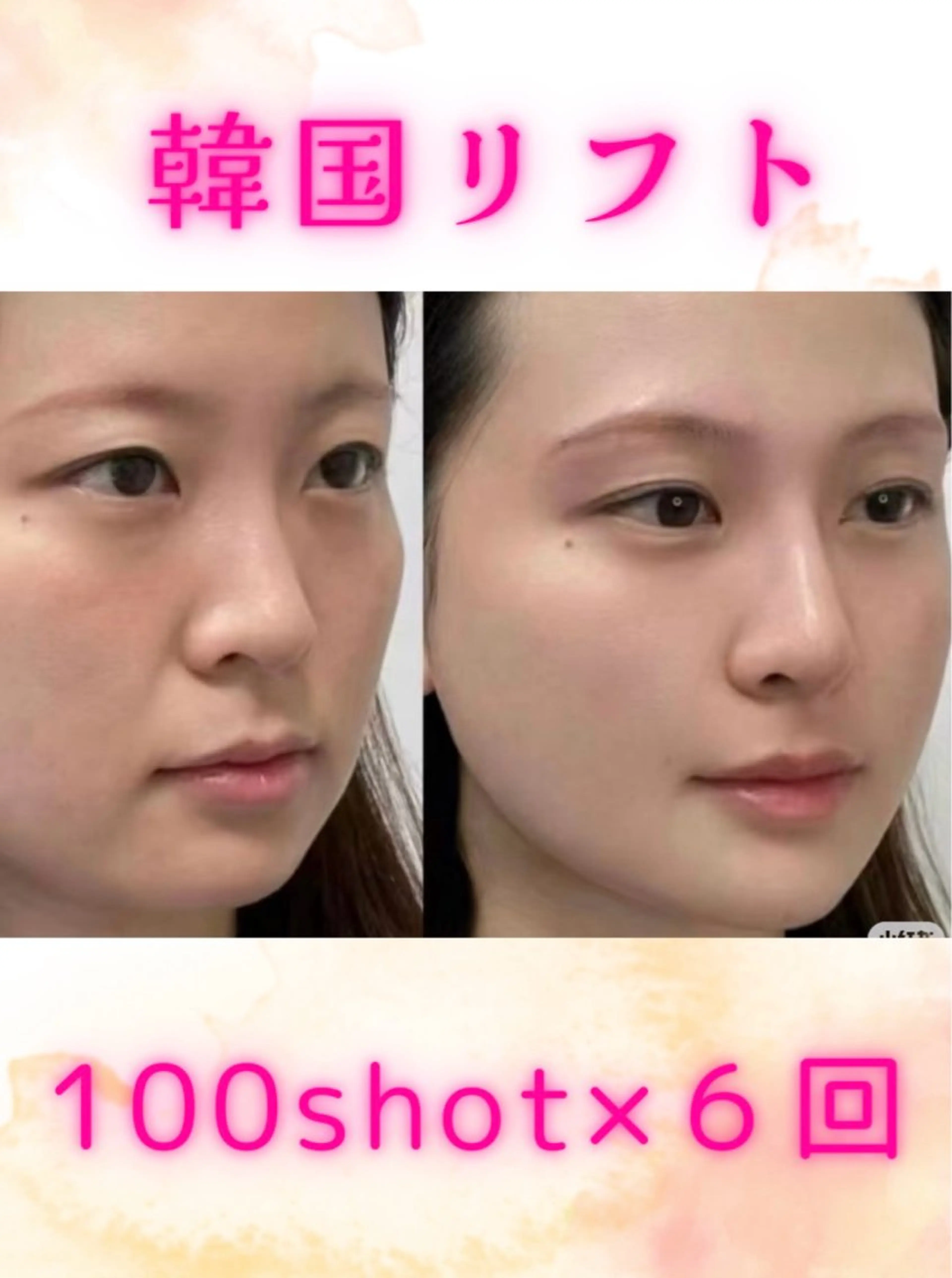 マツエク・マツパ エステ リラク 愛維美水光美肌専門店所属・愛維美水光美肌専門店 メンズレディースokのエステ・リラクイメージ