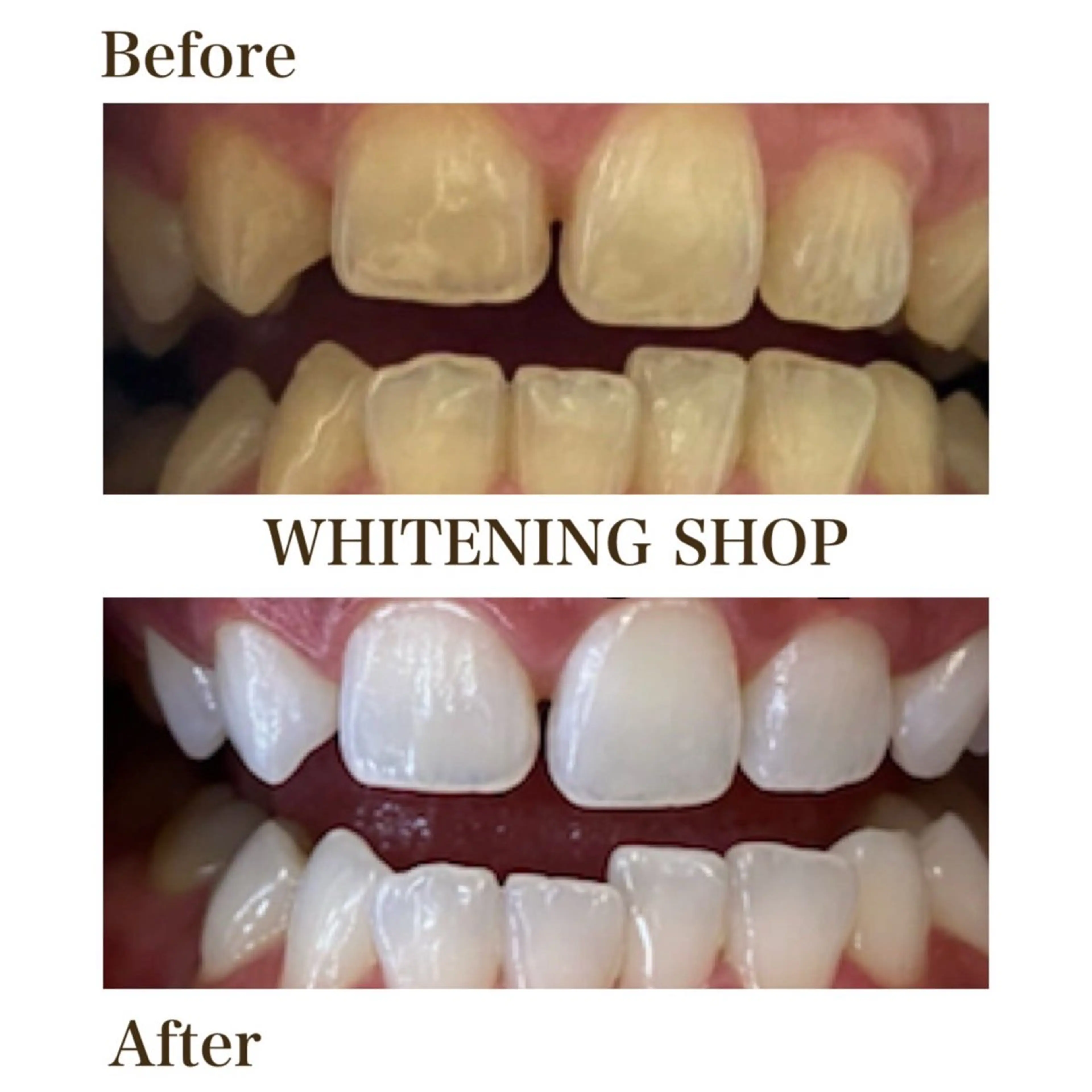 メンズ 学生（メンズ向け） エステ リラク ホワイトニング ショップ川越店のエステ・リラクイメージ