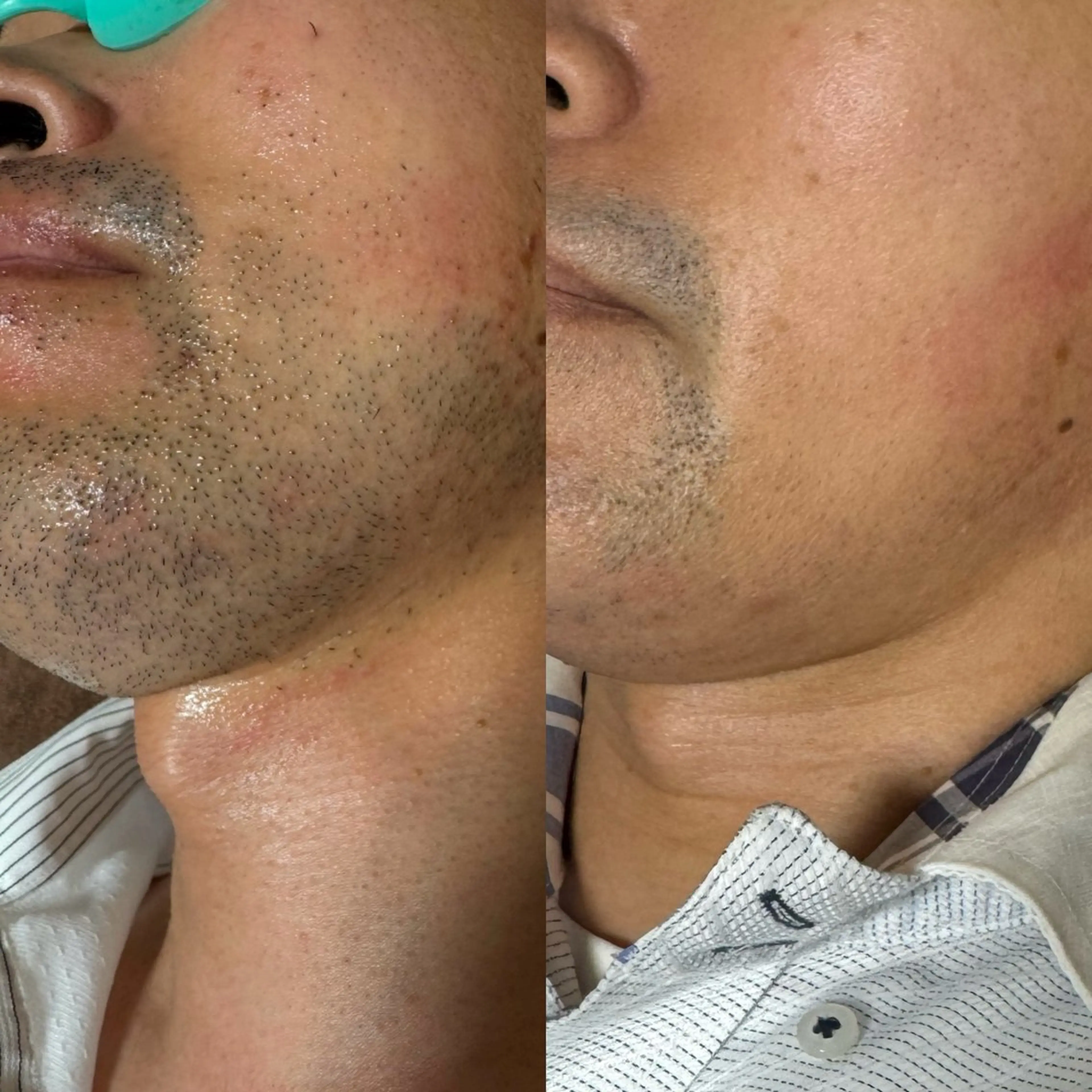 脱毛 六本木脱毛andS 店長Sachiのエステ・リラクイメージ