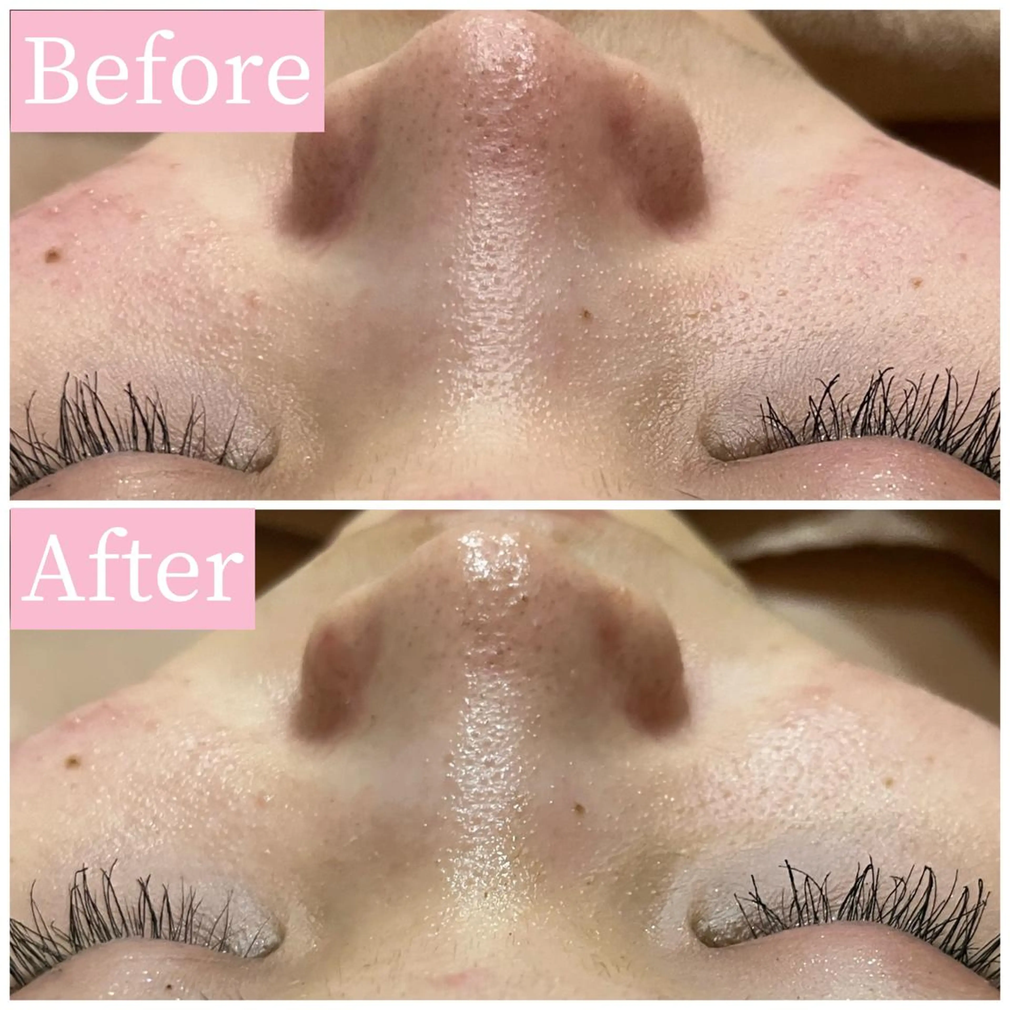 ハーブピーリング専門 muro.のエステ・リラクイメージ