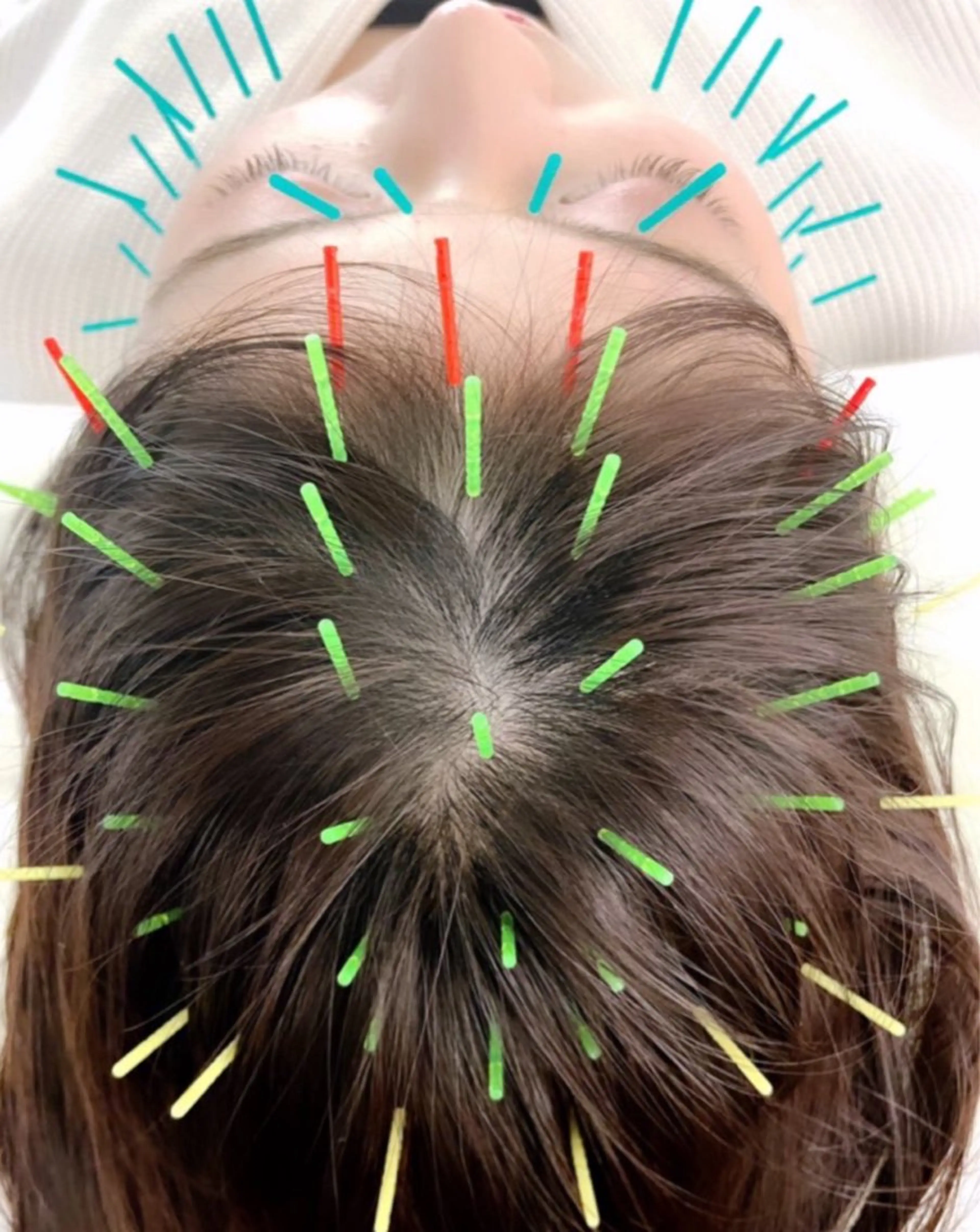 エステ リラク 小顔美容鍼専門サロン 渋谷YZのエステ・リラクイメージ