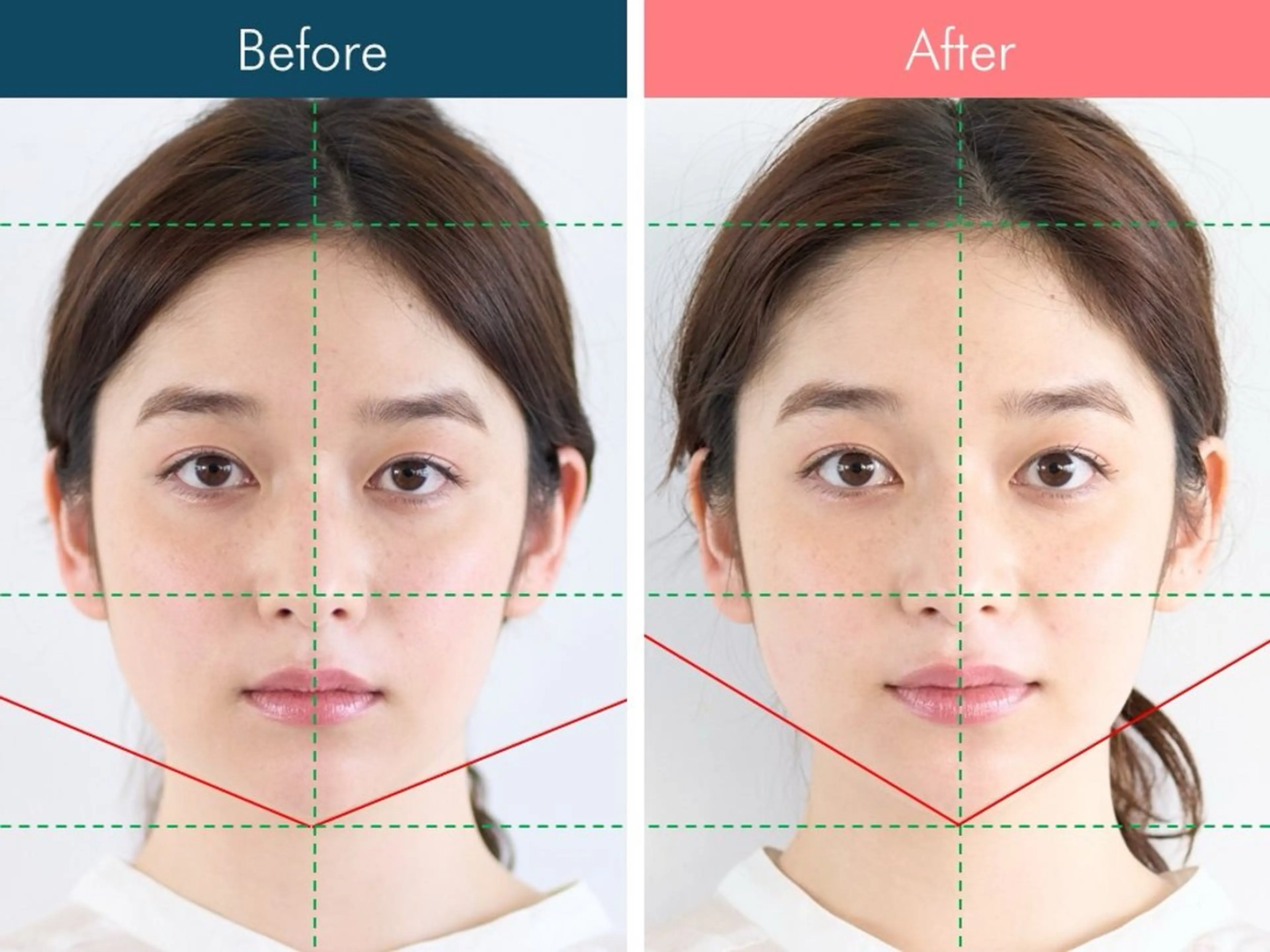 美容鍼専門サロン Hari Lounge 恵比寿本店所属・菅野 舞のエステ・リラクイメージ