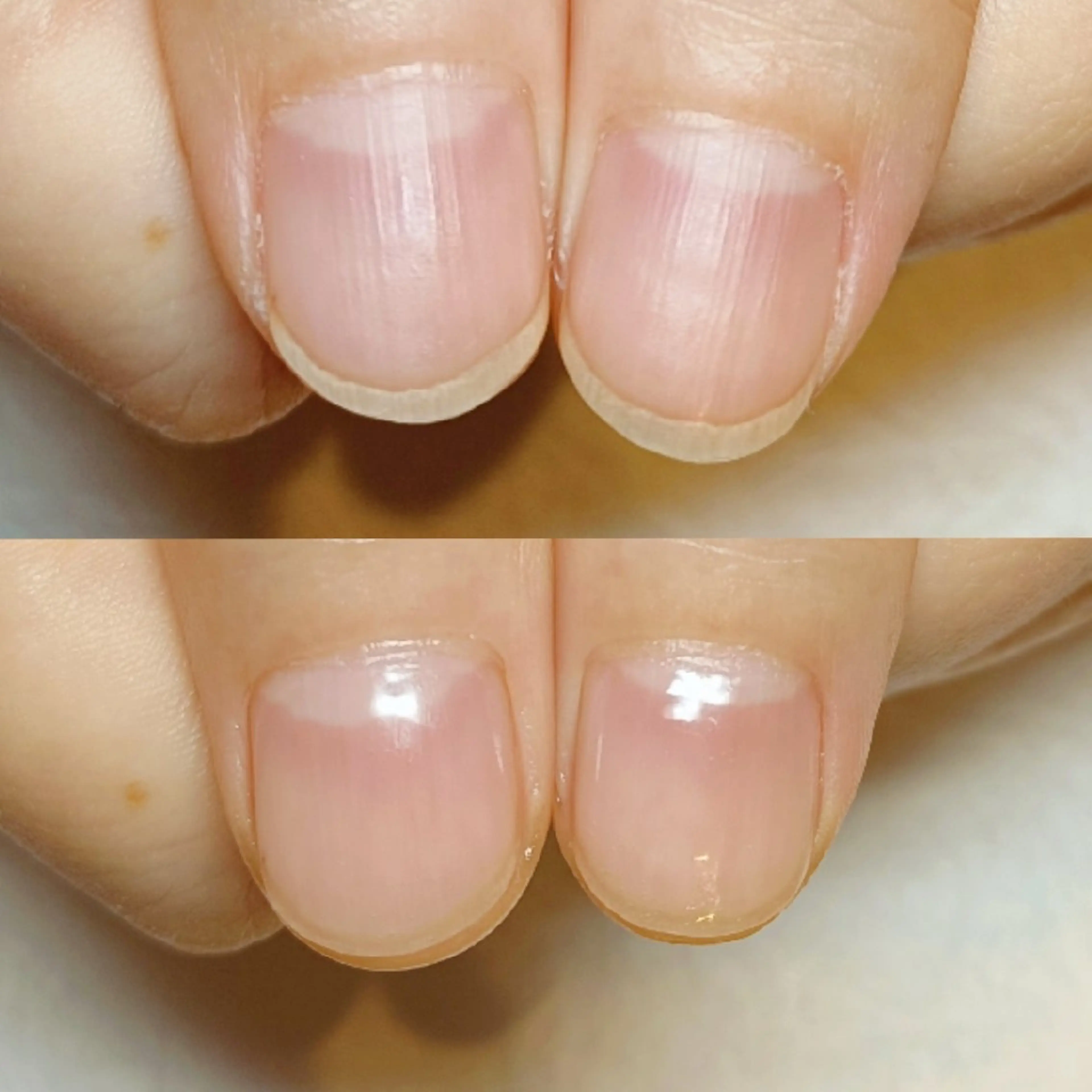 ネイル ハンドネイル ハンドケア 深爪矯正/爪育成ケア manie nailのネイルデザイン