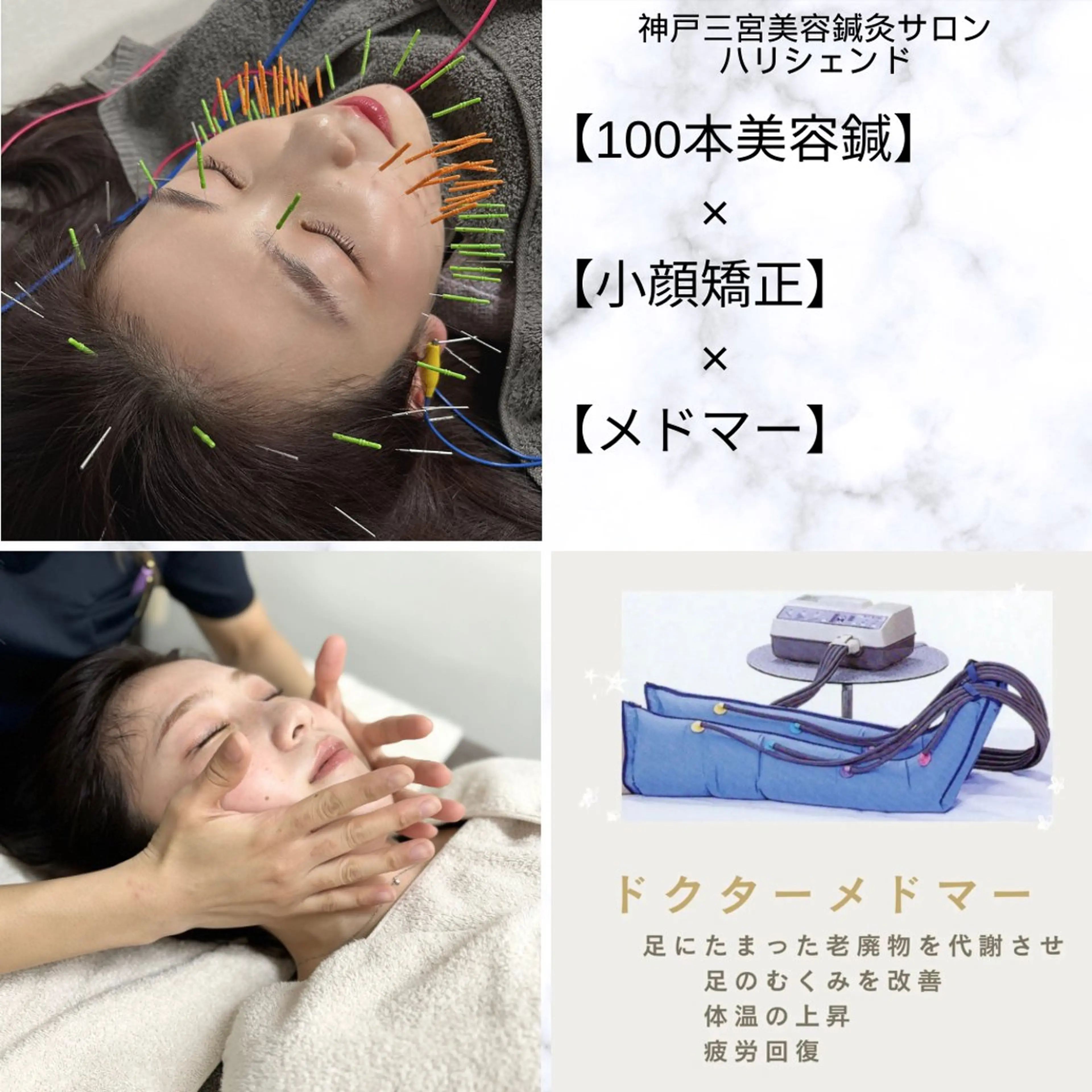 人気No,1！鍼100本使用！リフトアップ、エラ改善【鍼100本】×【電気】×【小顔矯正】約90分の写真