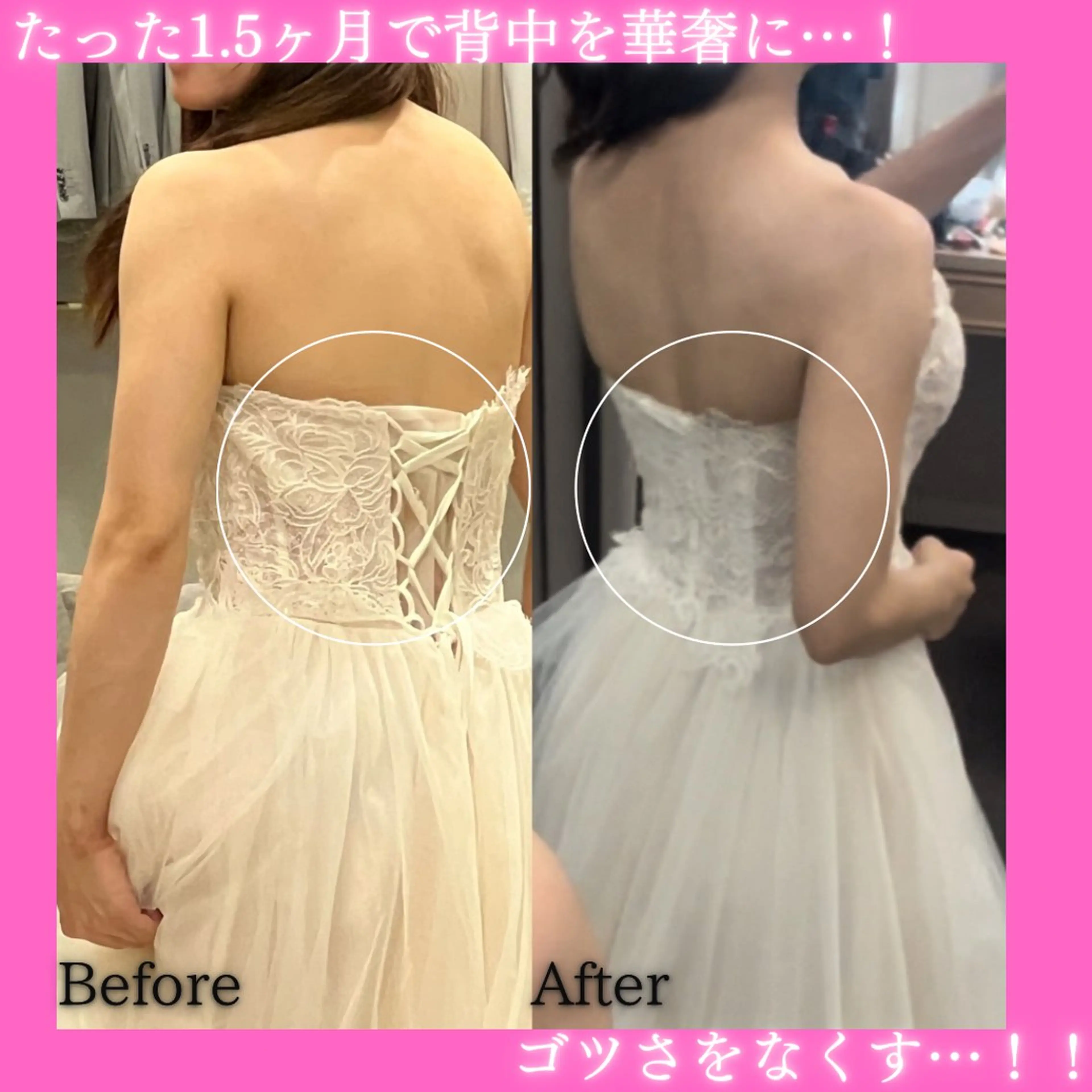 エステ リラク 痩身&美肌サロン 堀米✨のその他イメージ