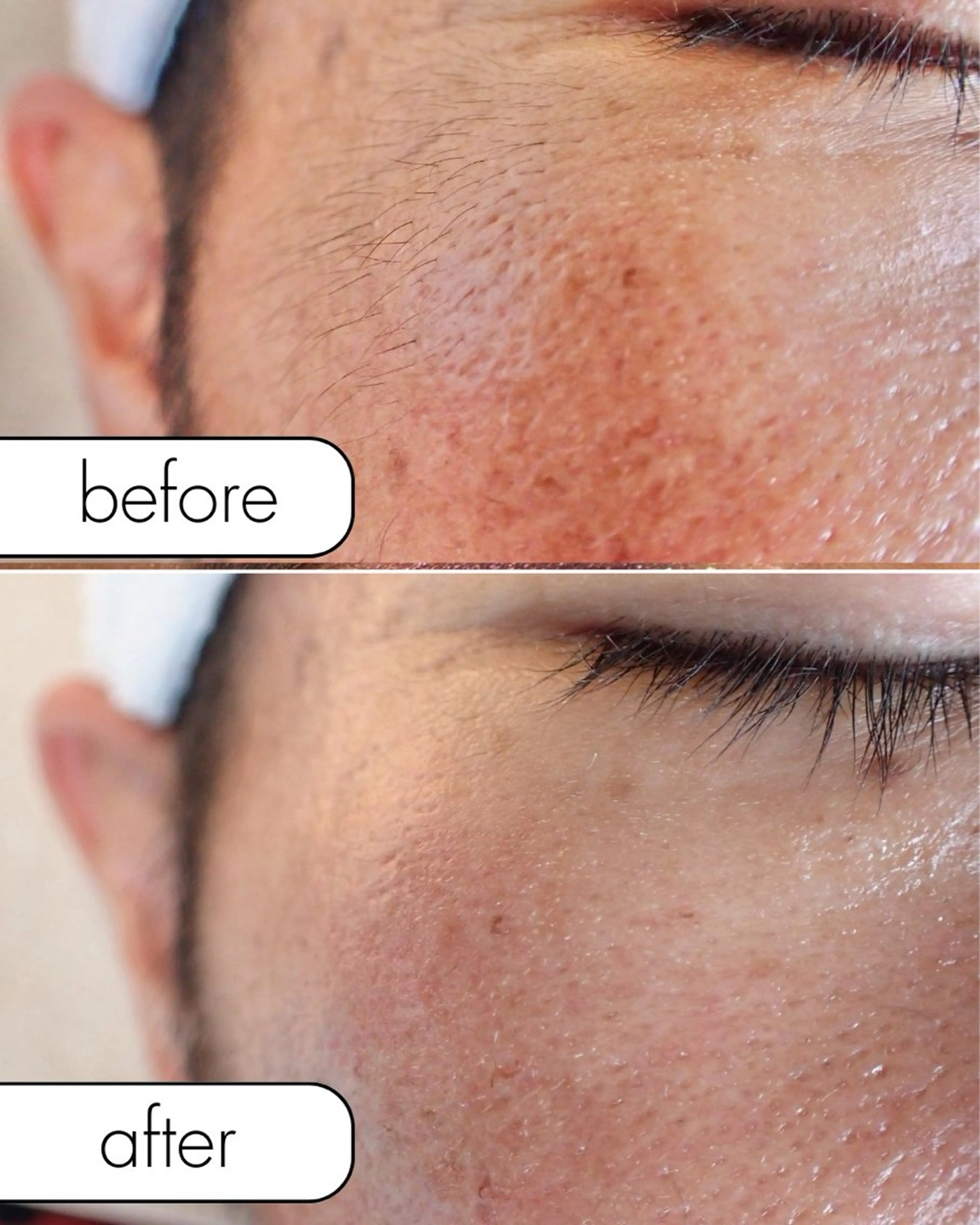 脱毛 蝶式糸除毛専門salon aco所属・糸除毛専門salon acoのエステ・リラクイメージ