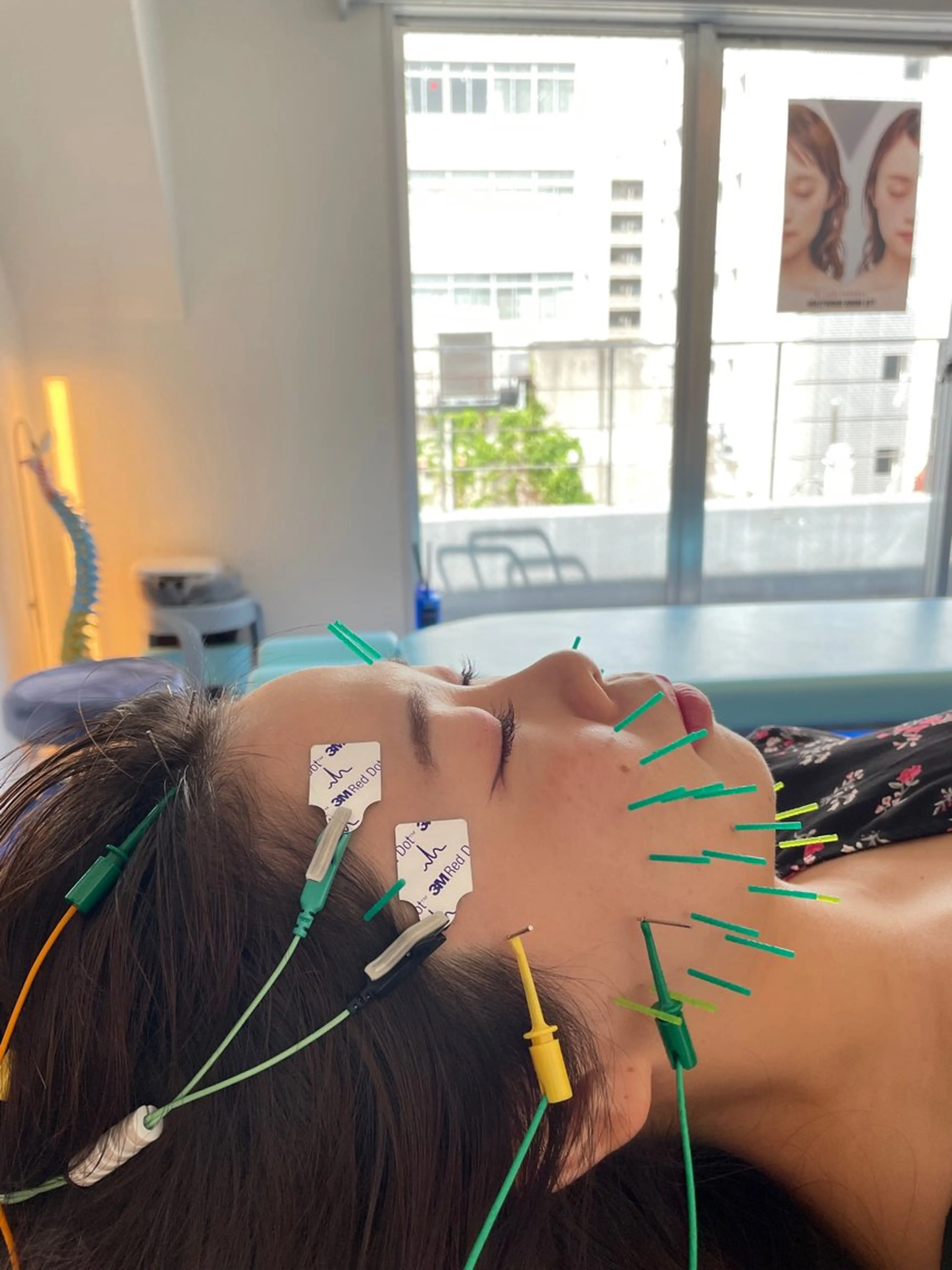 エステ リラク 小顔美容鍼専門サロン 渋谷YZのエステ・リラクイメージ