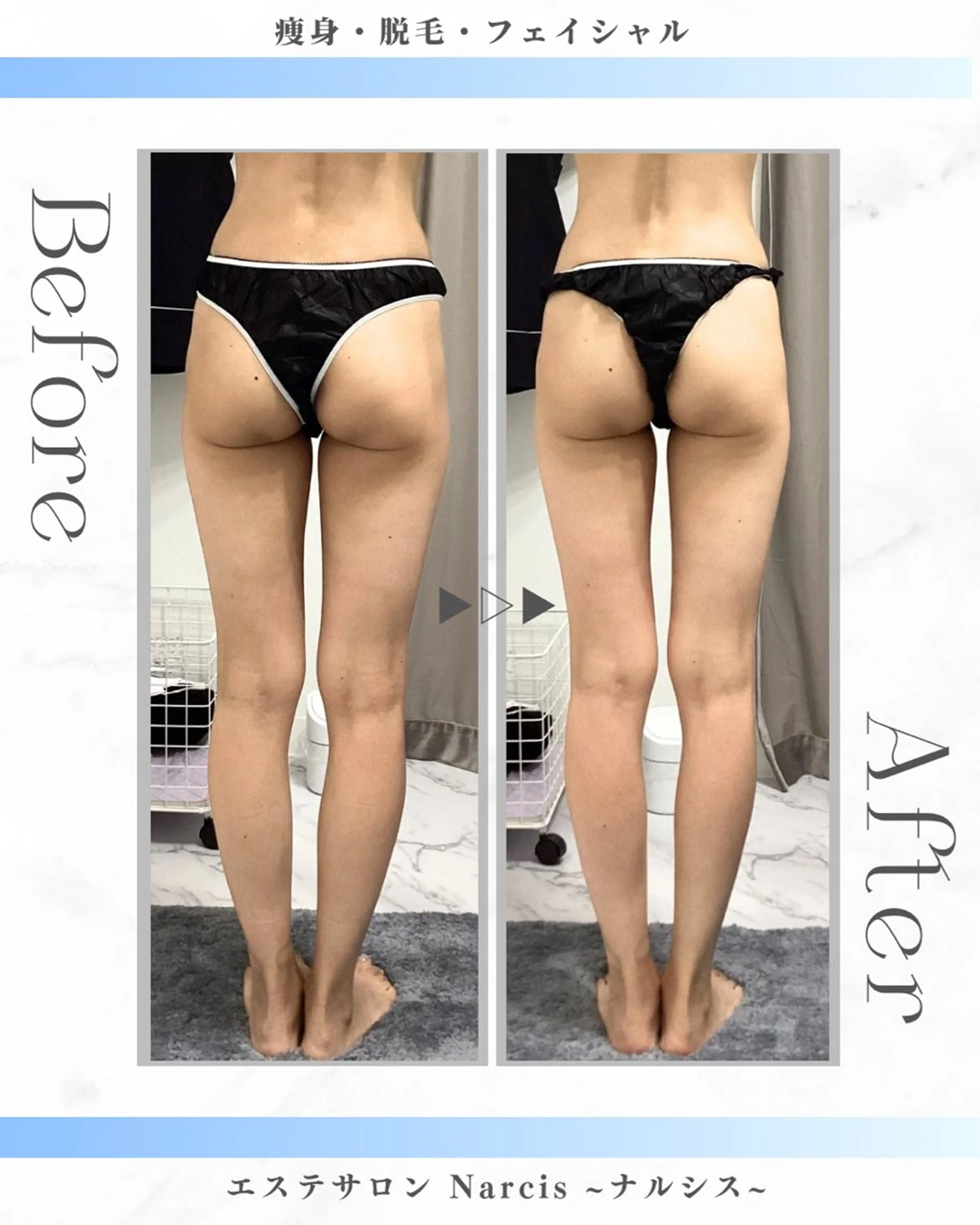 エステサロンNarcis〜ナルシス〜所属・脱毛＆痩身エステ Narcisのエステ・リラクイメージ