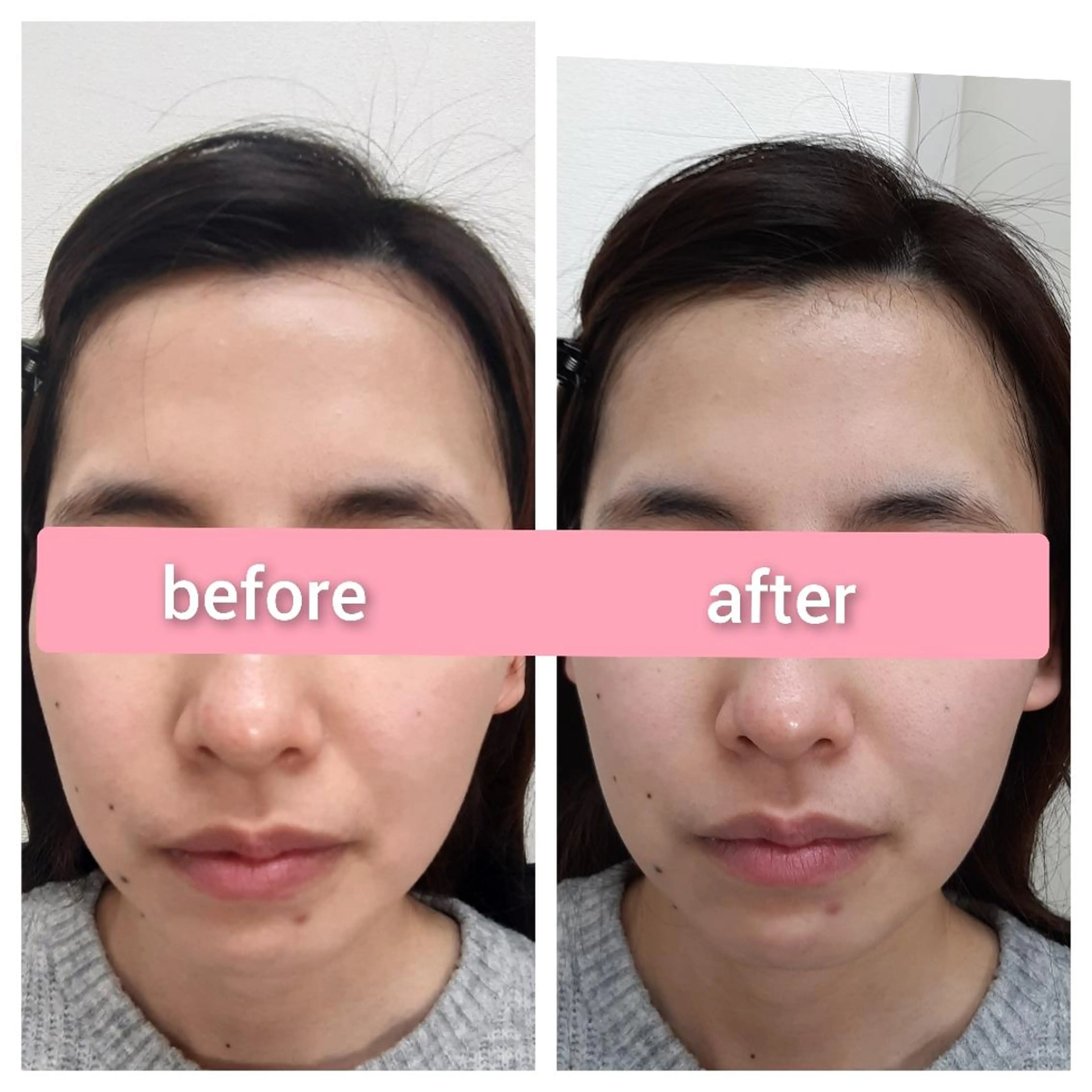 デ・アイム王寺所属・たるみ解消エミリーノ 米田真美子のエステ・リラクイメージ