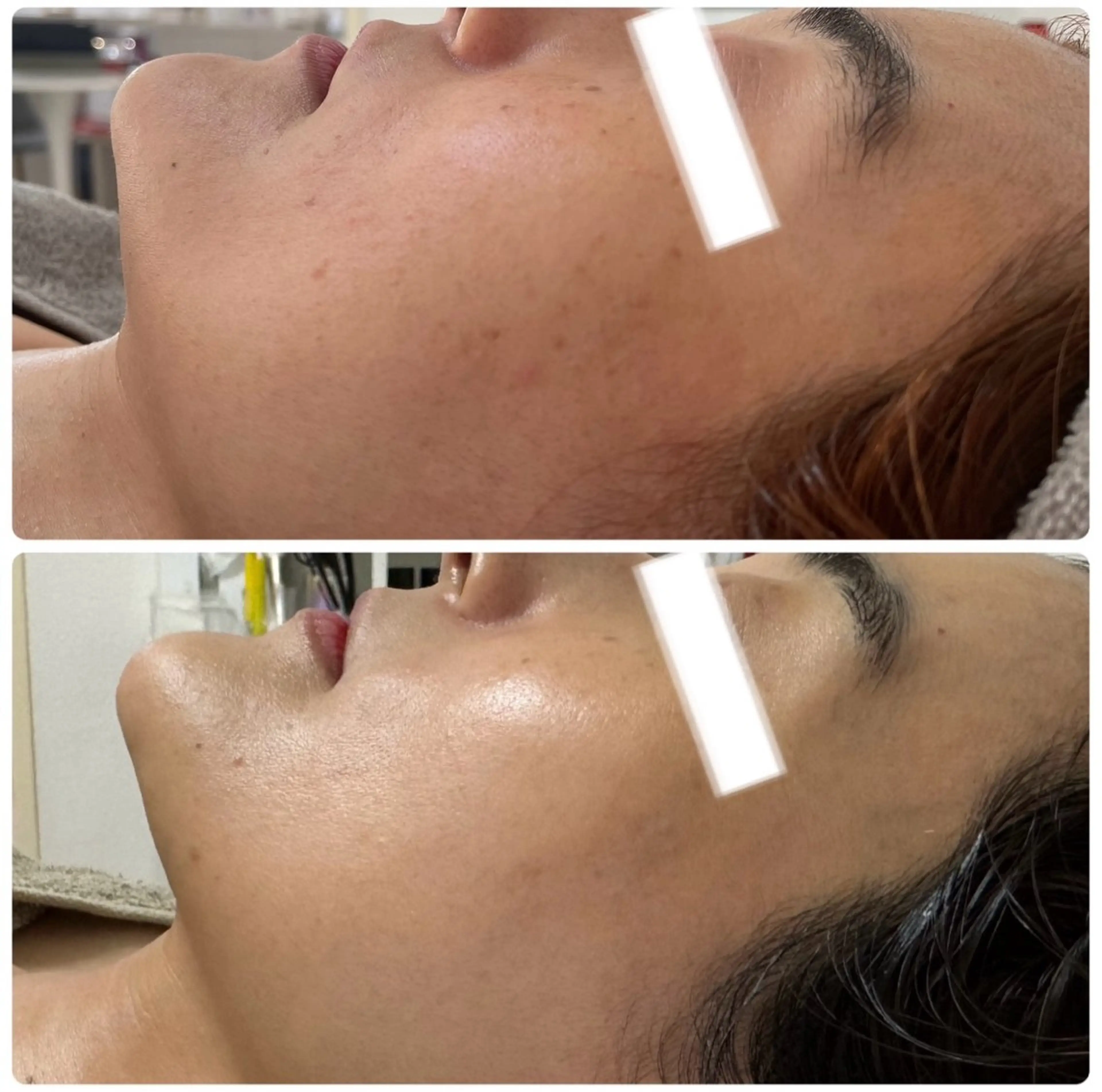 エステ Esthe salon Blanche(エステサロンブランシュ)所属・小顔リフトアップ 美肌改善専門店のエステ・リラクイメージ