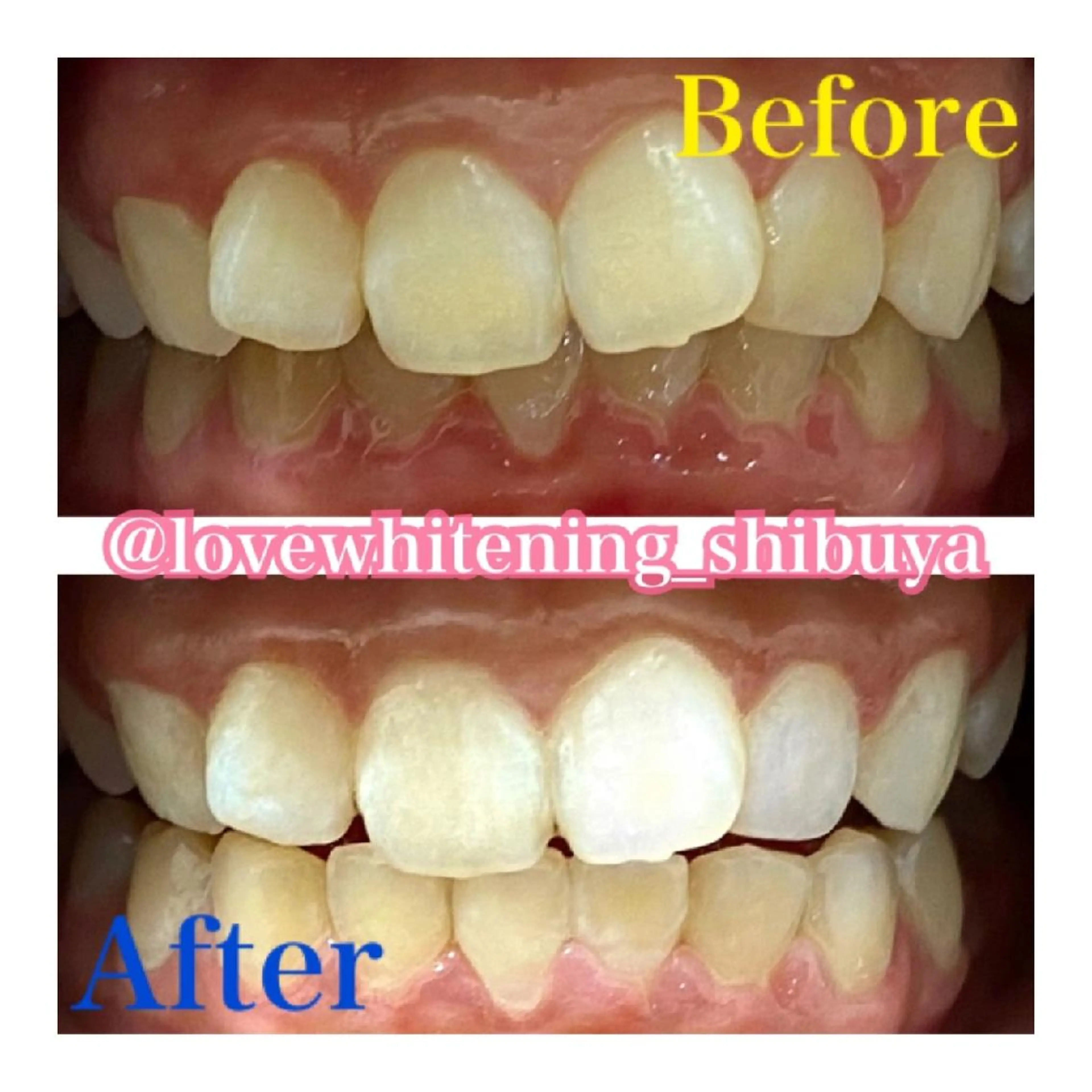 LOVE ホワイトニング渋谷のその他イメージ