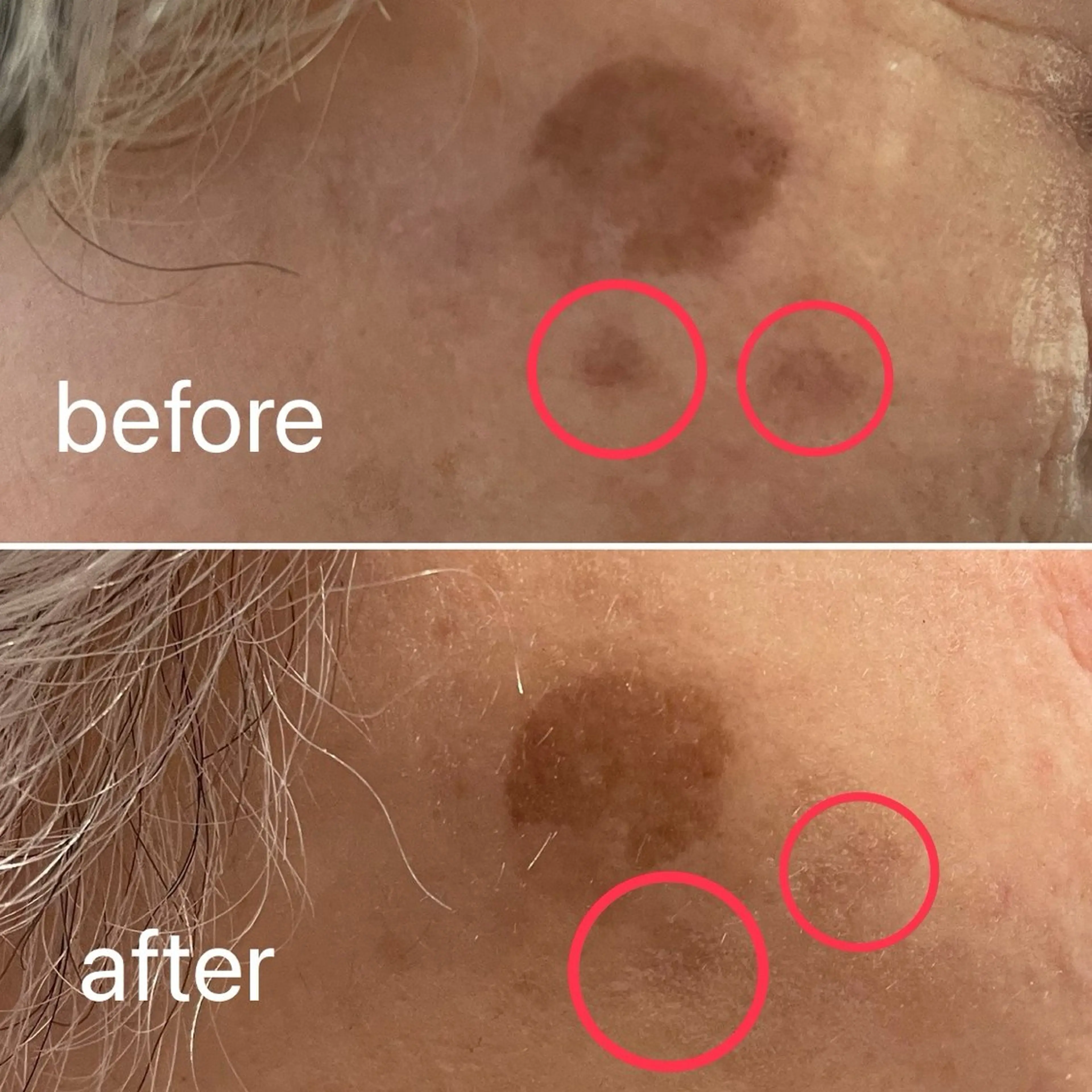 痛くないシミ取り 【荻窪】石橋のヘアスタイル