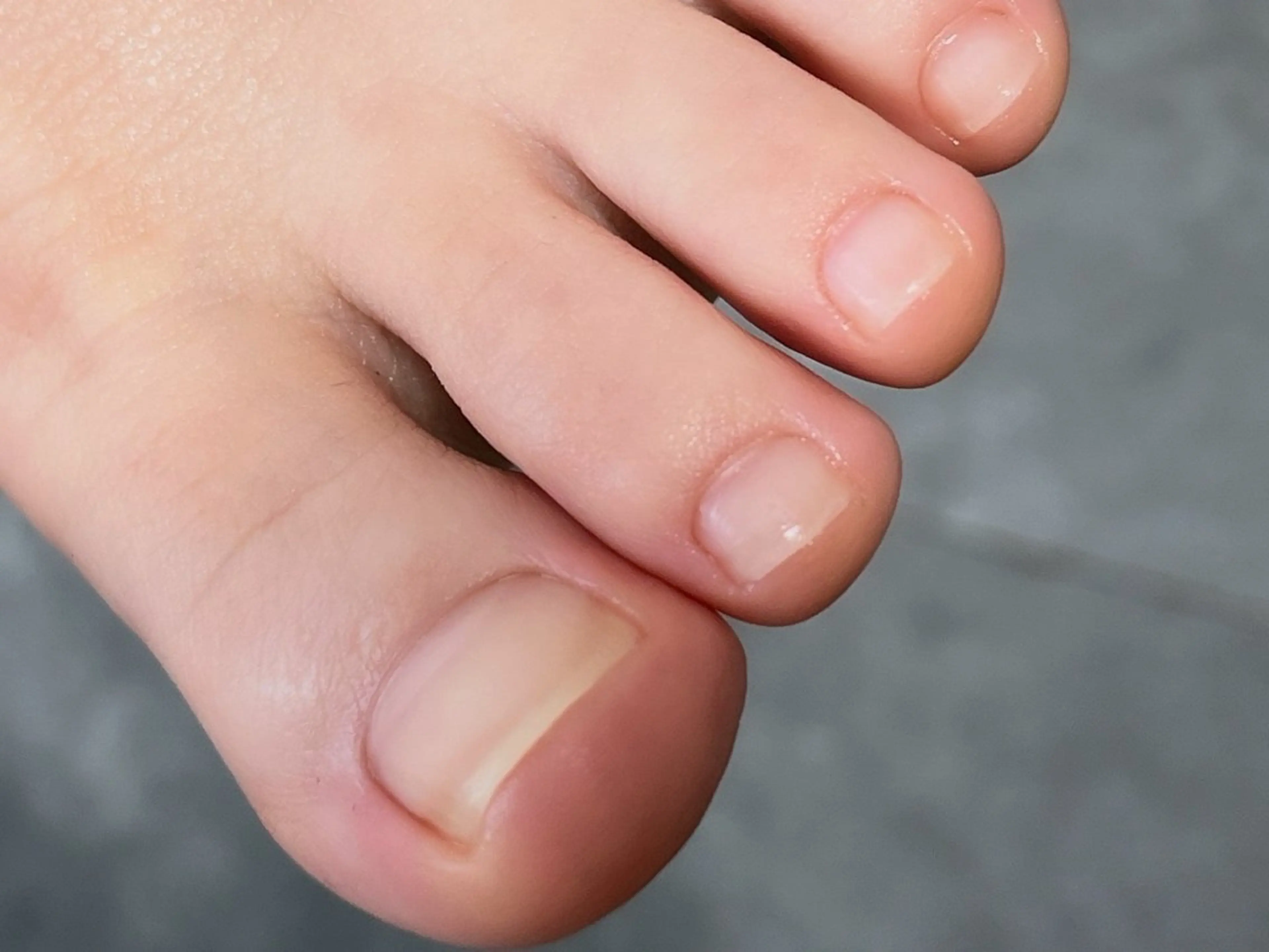 ネイル VERMA ネイルケアsalonのネイルデザイン