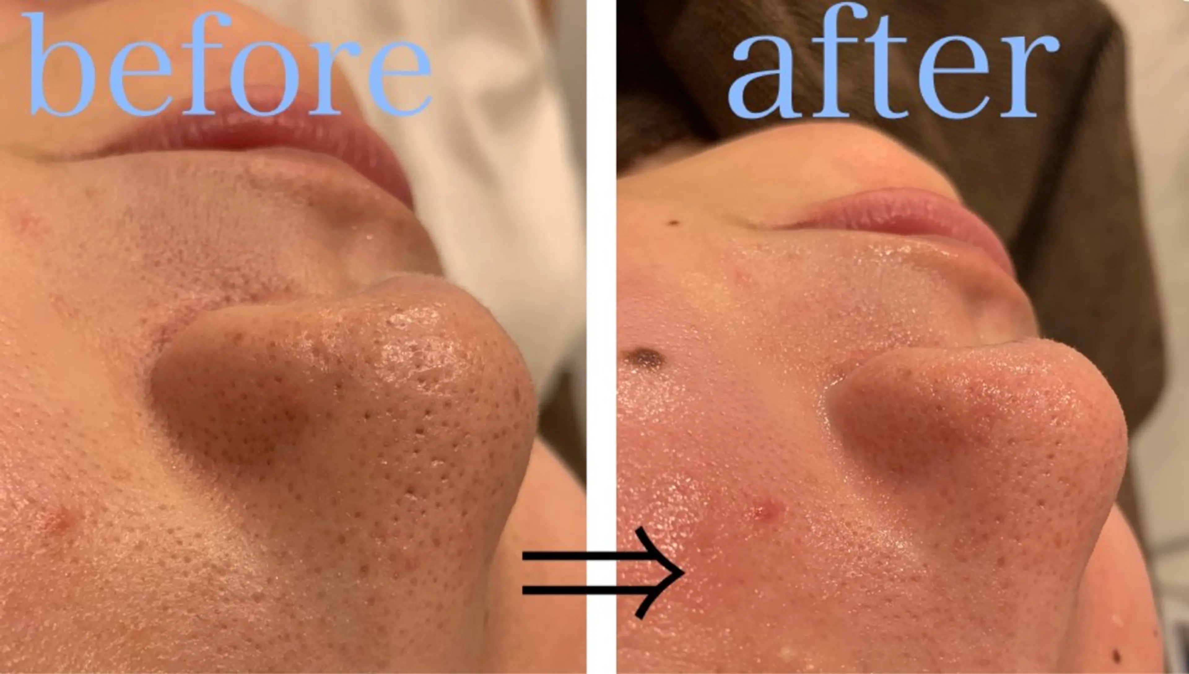 リジュベ所属・Rejuve ﾘｼﾞｭﾍﾞのエステ・リラクイメージ