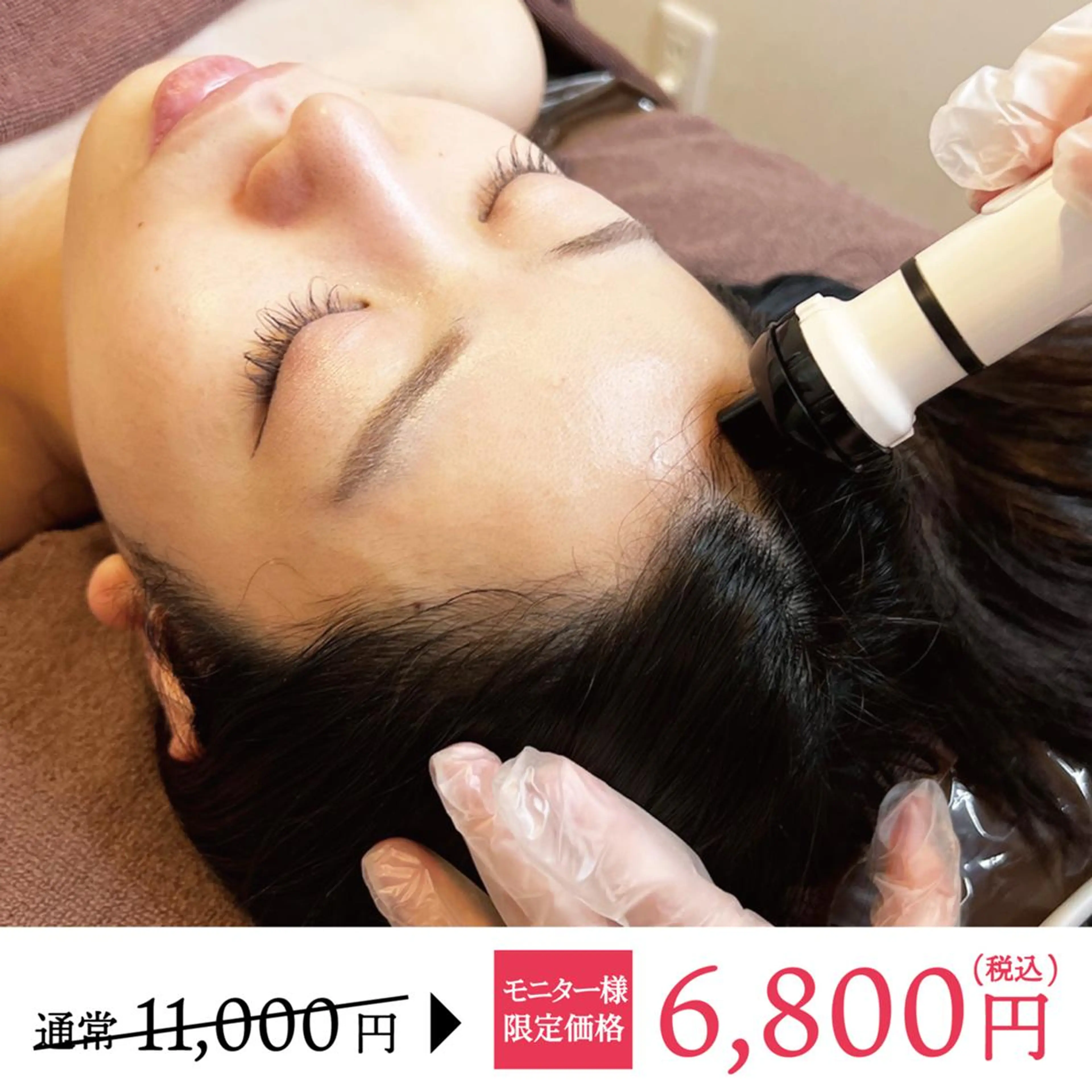 モニター様限定❣️【ハリ・コシのある髪へ!プラズマスカルプ】最新のプラズマで育毛促進・頭皮改善✨の写真