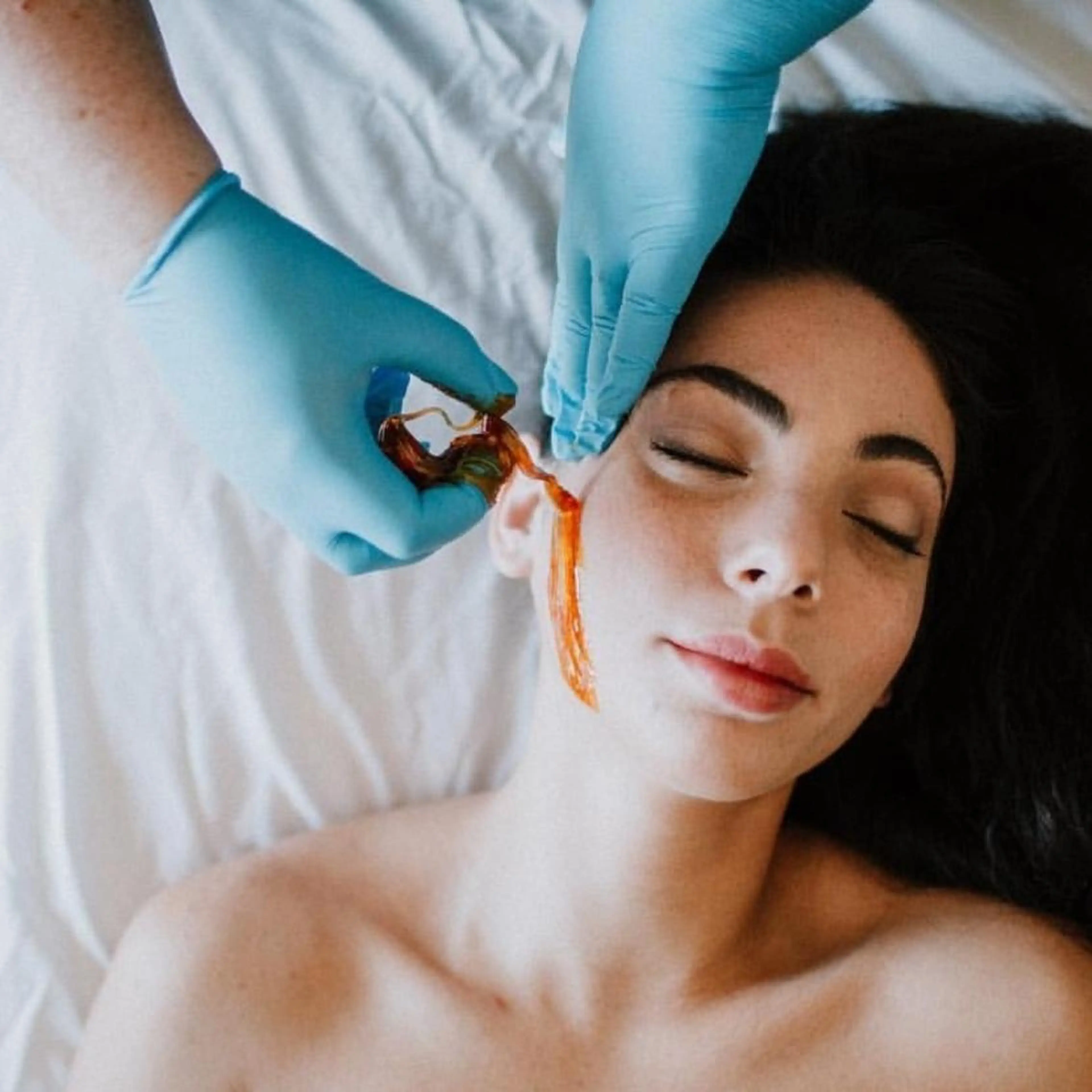 顔脱毛・フェイシャルシュガーリング　鎮静パック付の写真